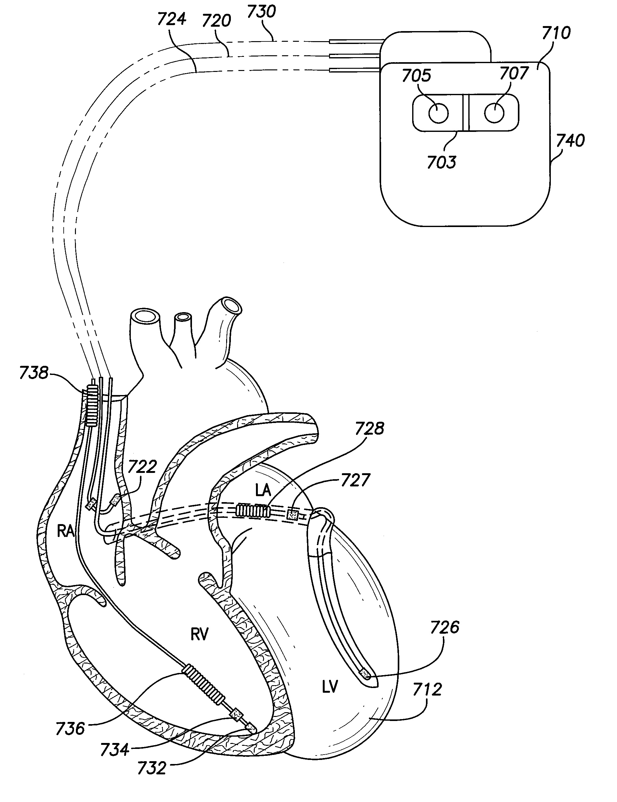 Methods and Systems for Monitoring Aterial Stiffness