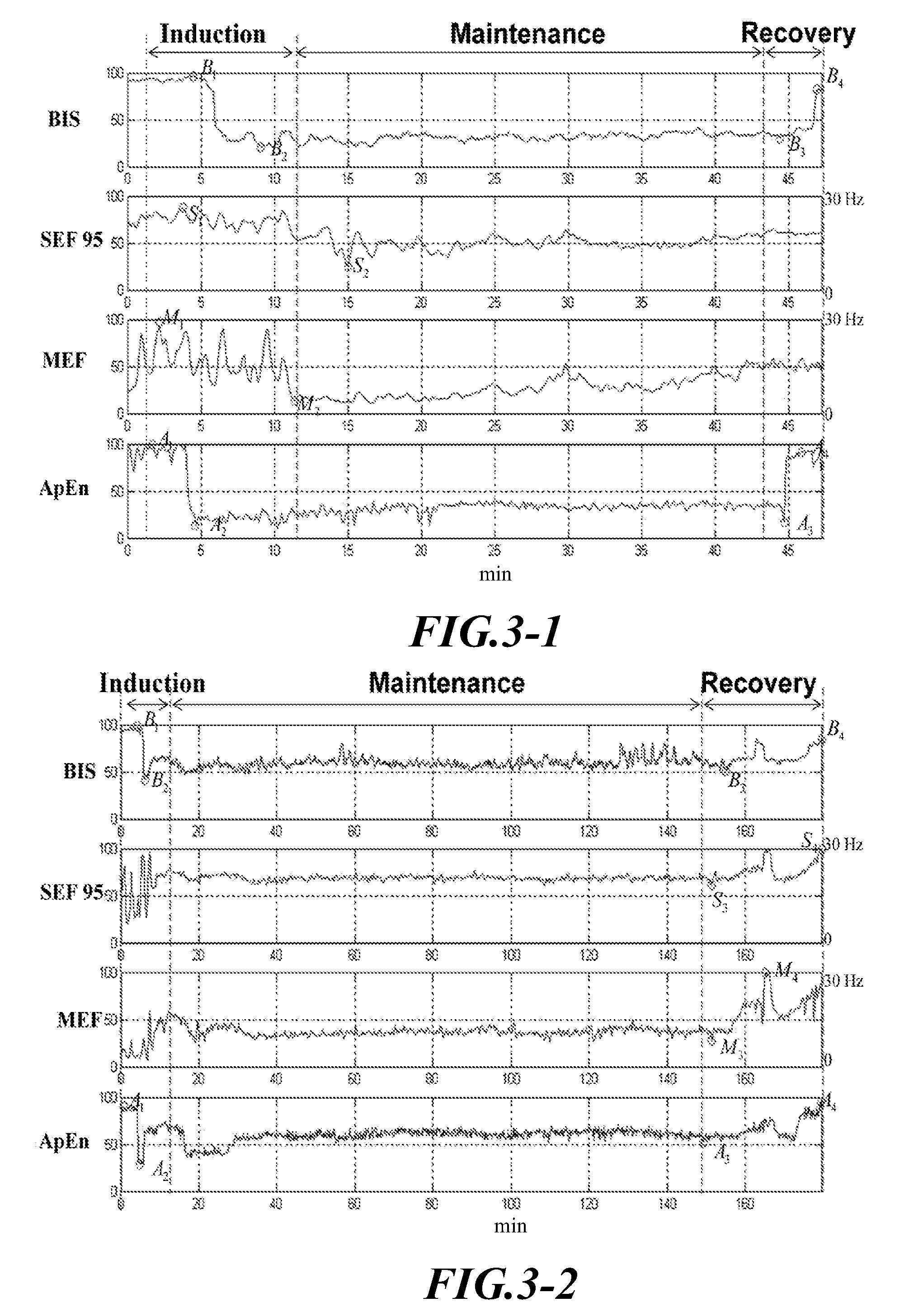 Method for Monitoring the Depth of Anesthesia