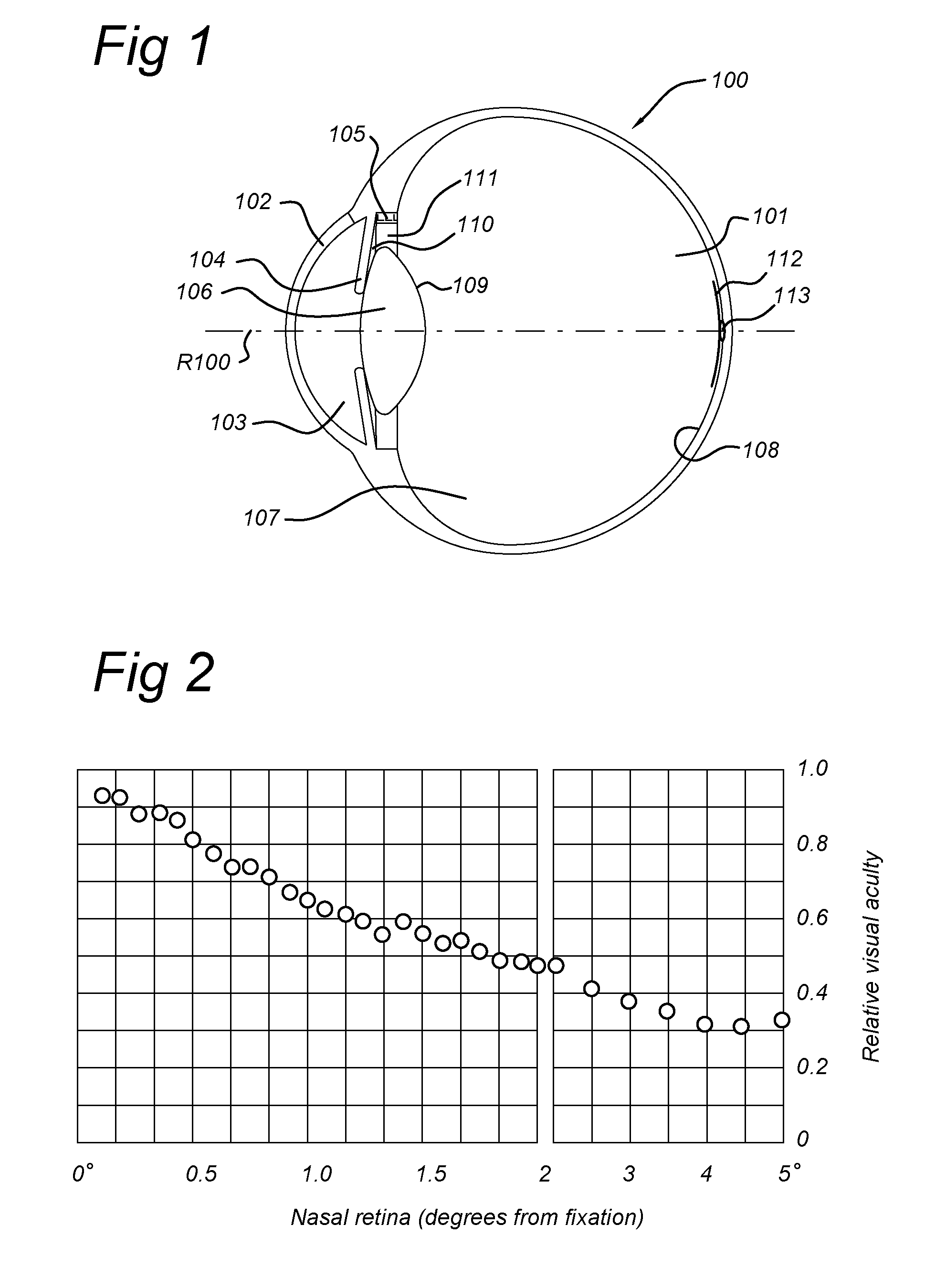 Intraocular lens