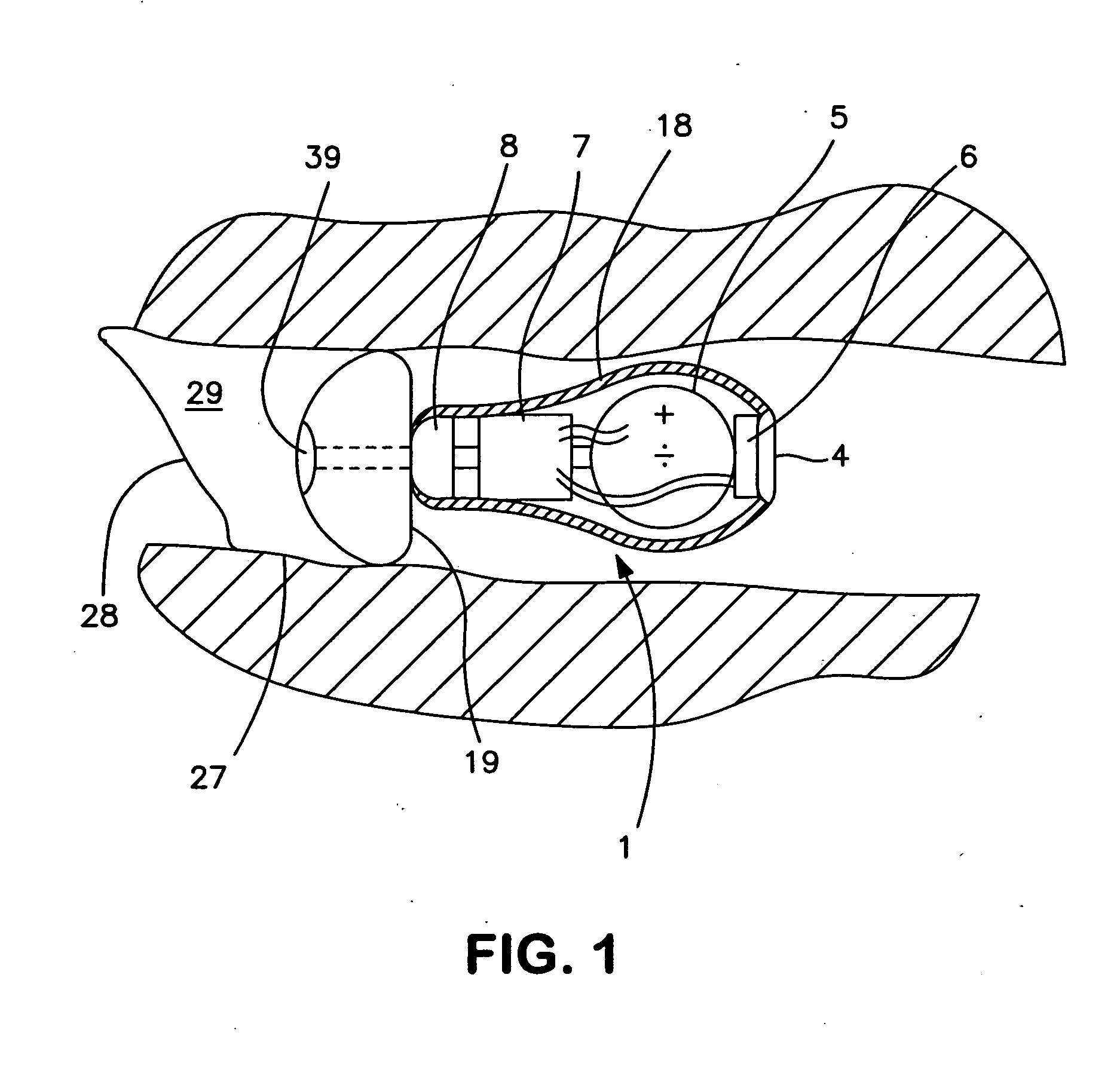 Hearing aid and handling tool