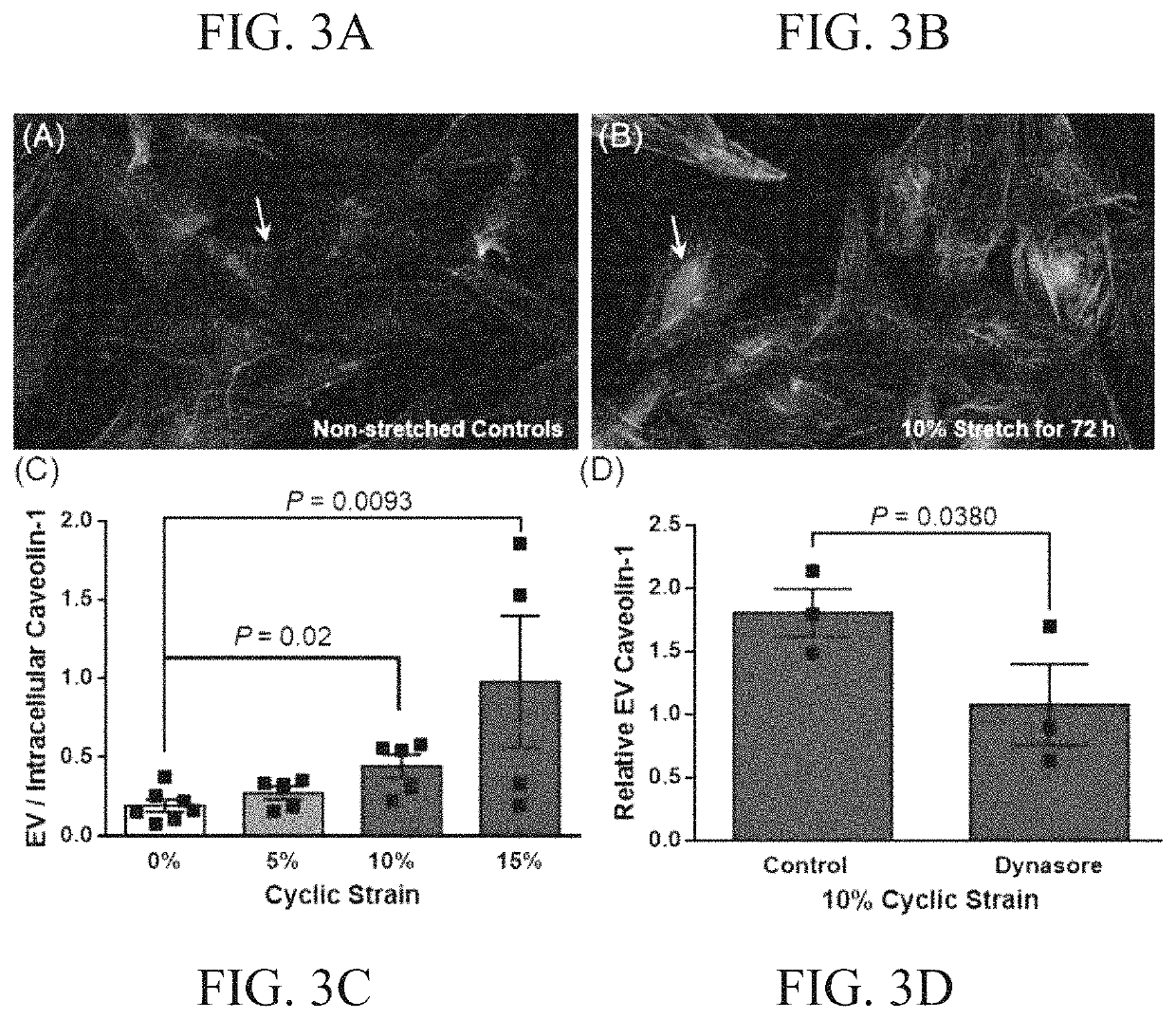 Materials and methods for the treatment of vascular calcification