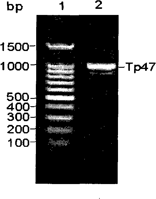 Syphilis spirochete membrane antigen with shorten expression and uses thereof