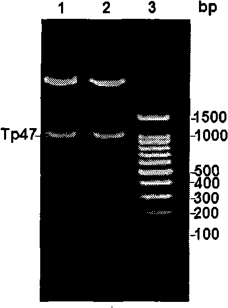 Syphilis spirochete membrane antigen with shorten expression and uses thereof