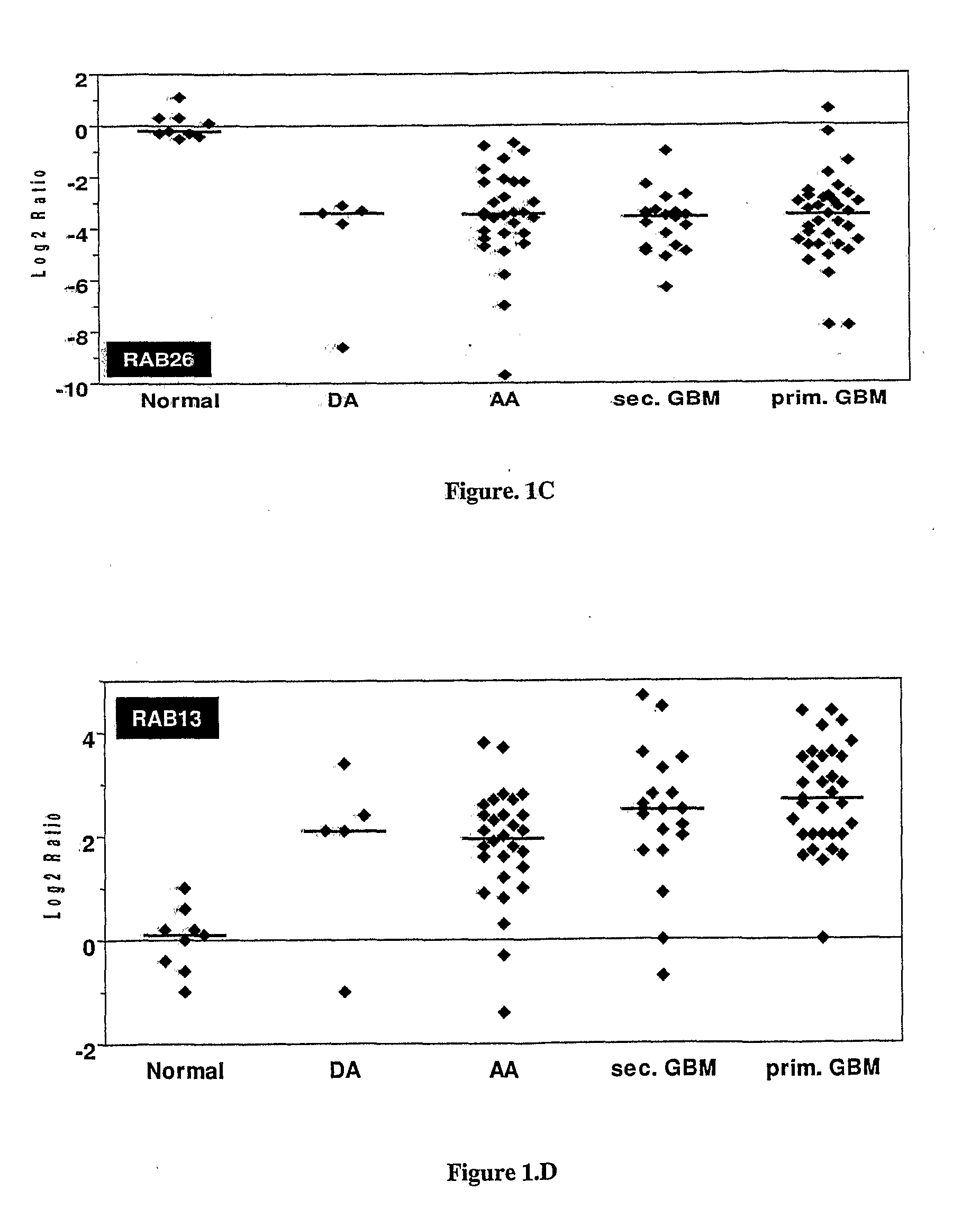 Novel Primers for Identification of Astrocytoma, Its Grades and Glioblastoma Prognosis