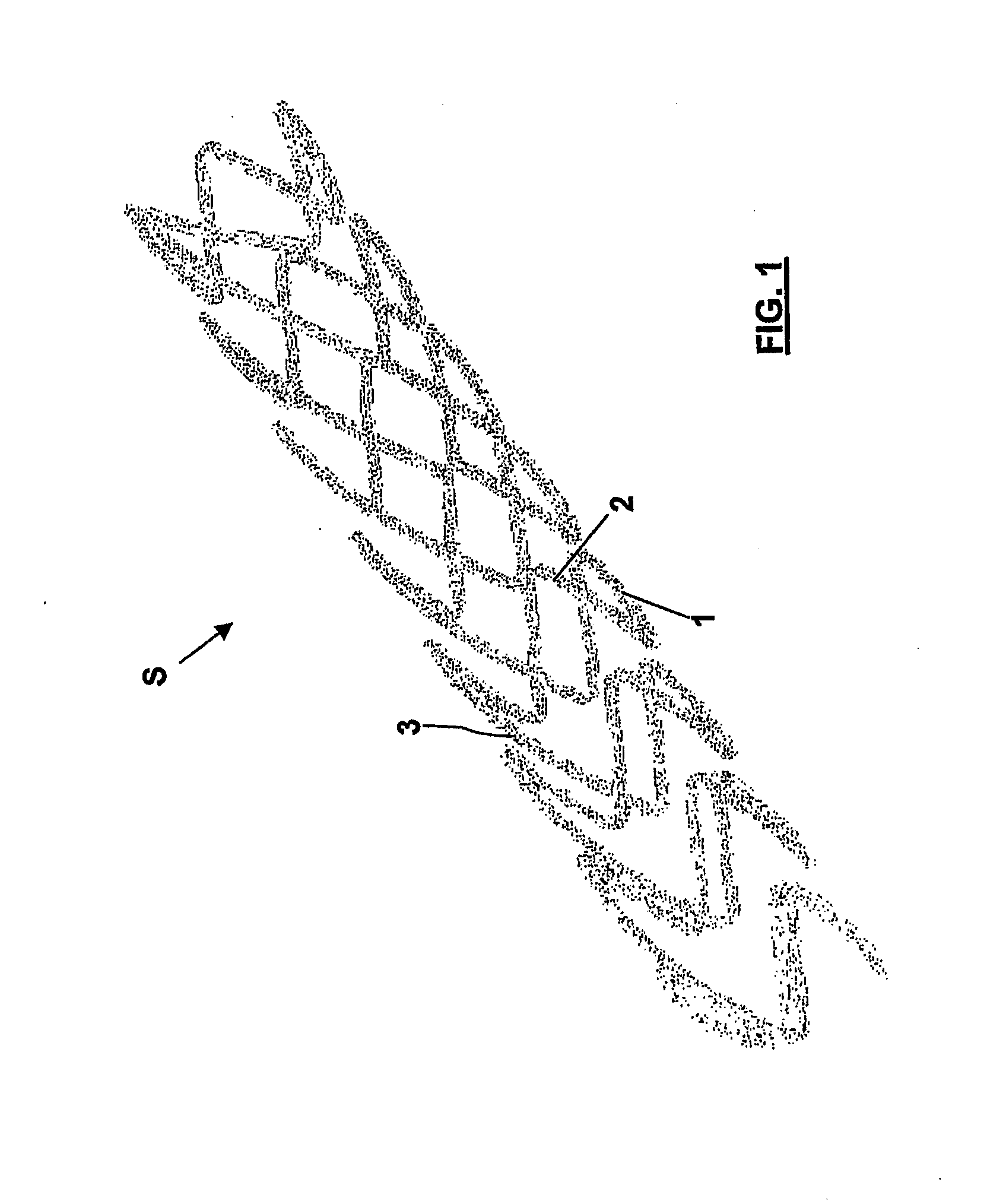 Endovascular prosthesis and relating manufacturing procedure