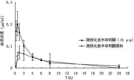Mifepristone slow release preparation characterized by gastric stasis and preparation method thereof