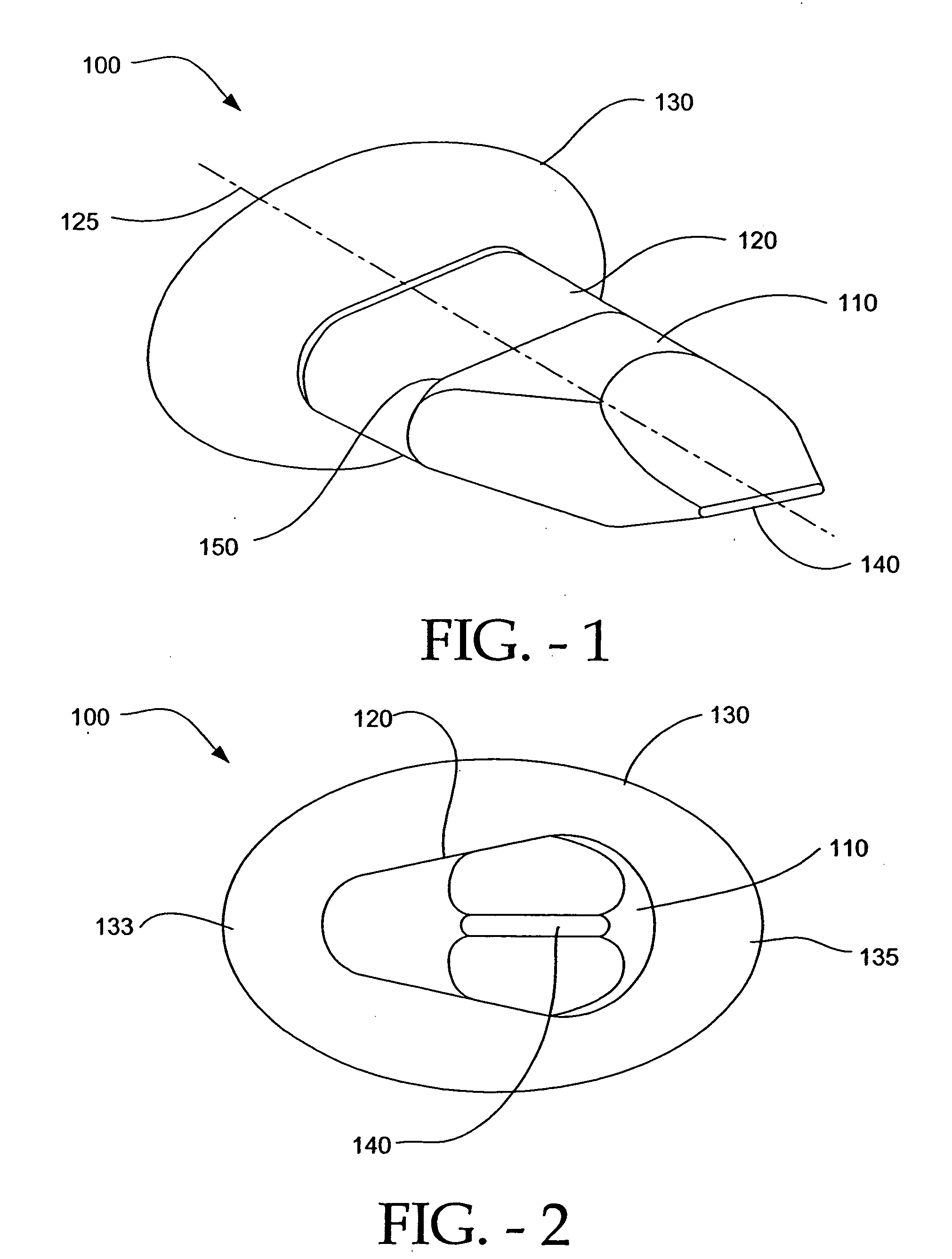 Interspinous process implant having deployable wings and method of implantation