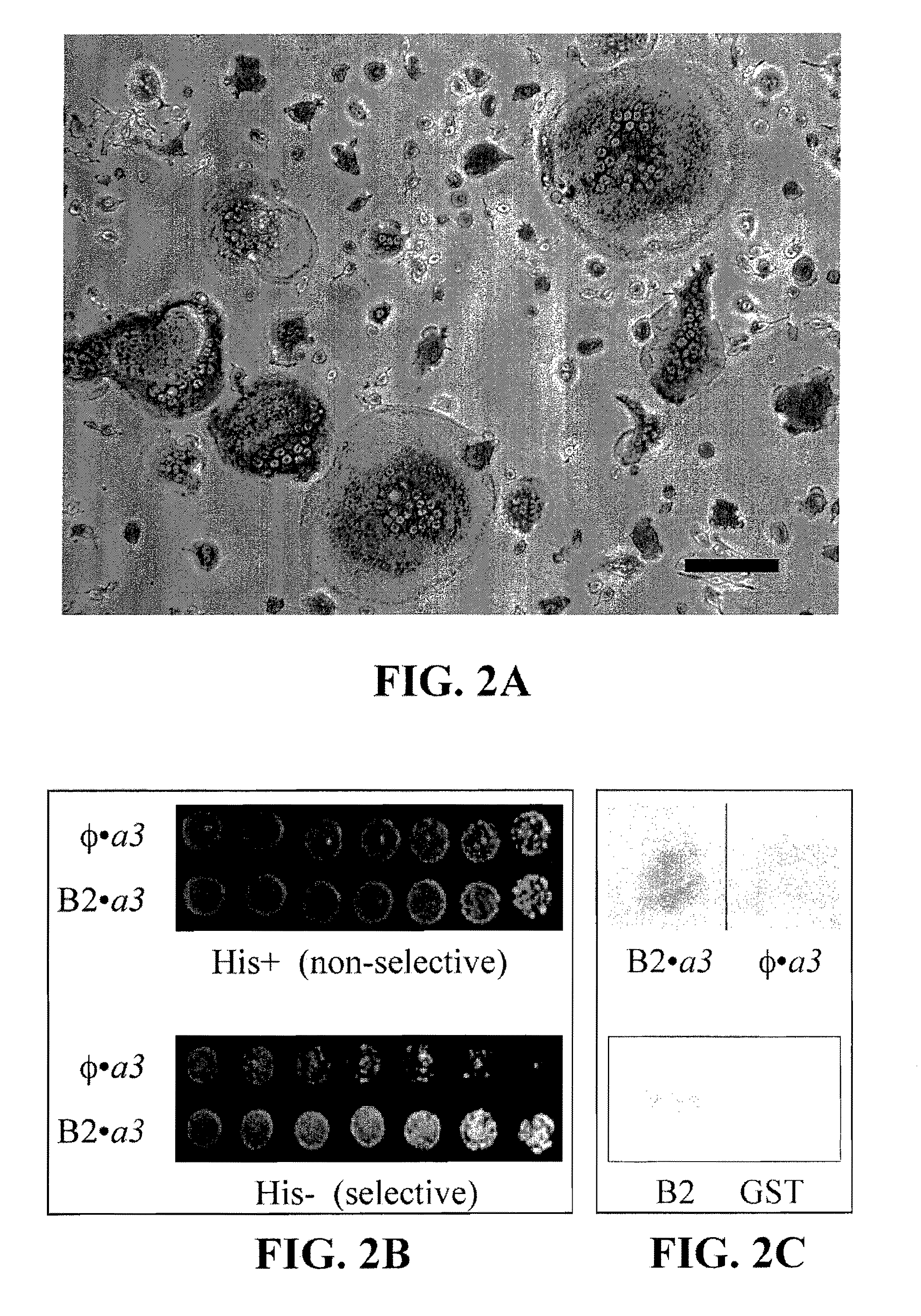 COMPOUNDS, COMPOSITIONS AND TREATMENTS FOR V-ATPase RELATED DISEASES
