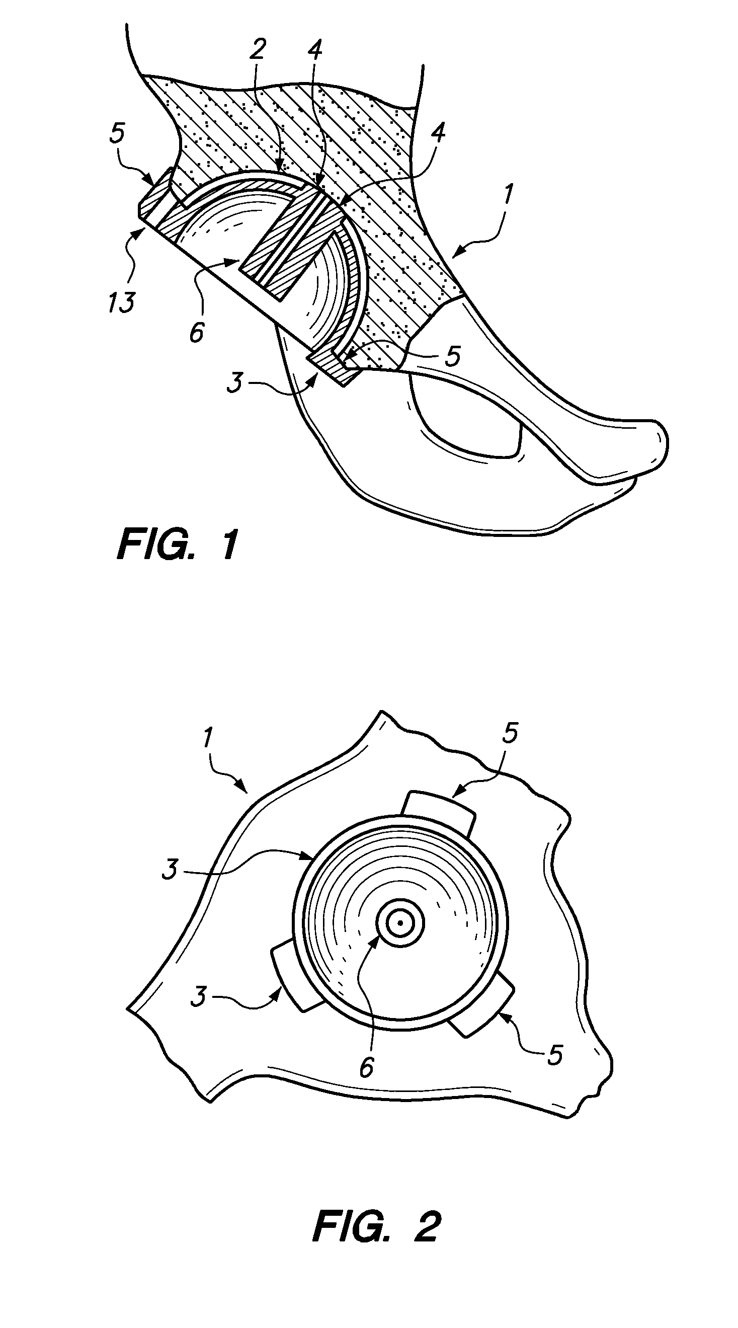 Device and method for achieving accurate positioning of acetabular cup during total hip replacement