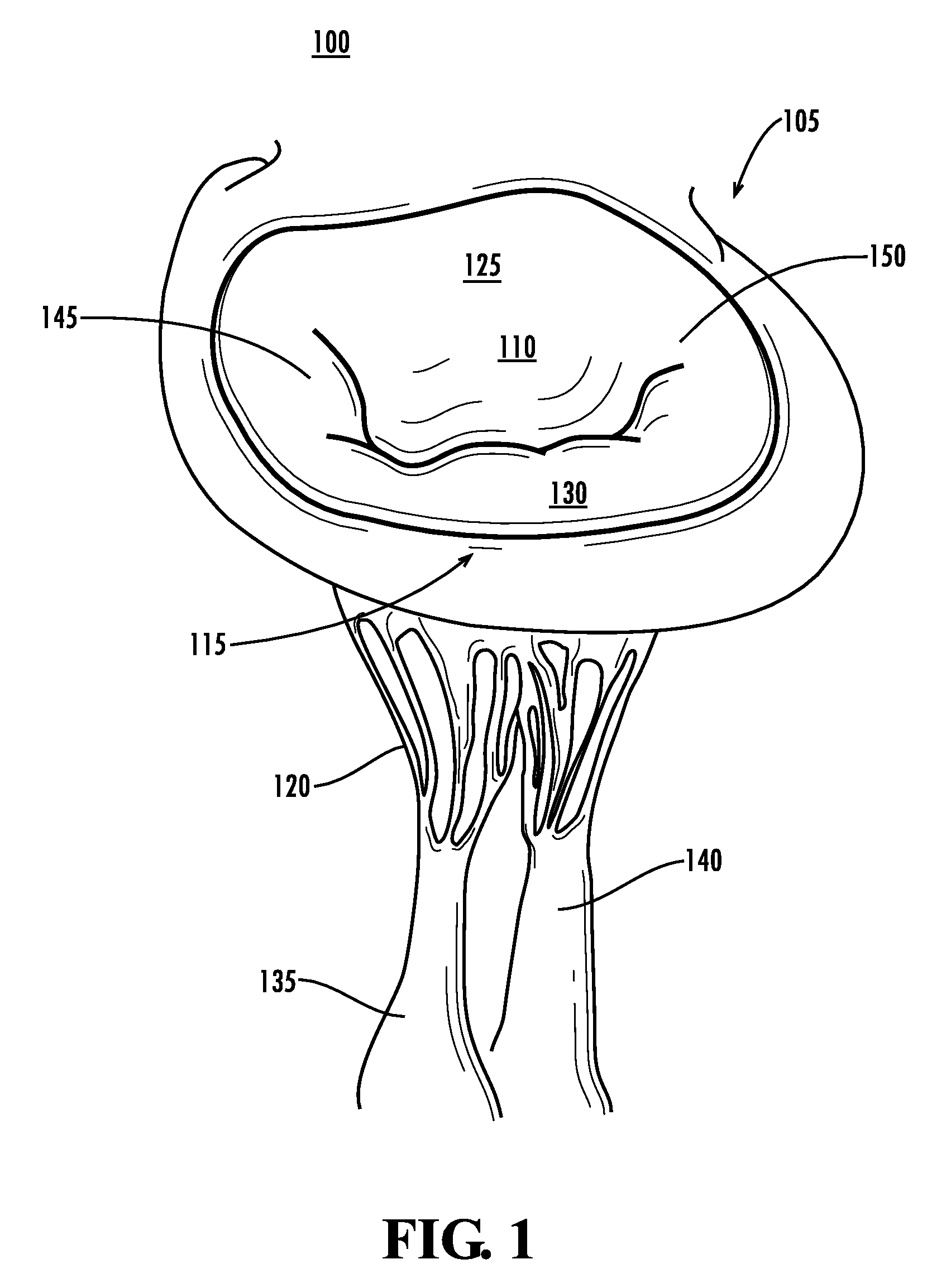 Papillary muscle position control devices, systems, & methods
