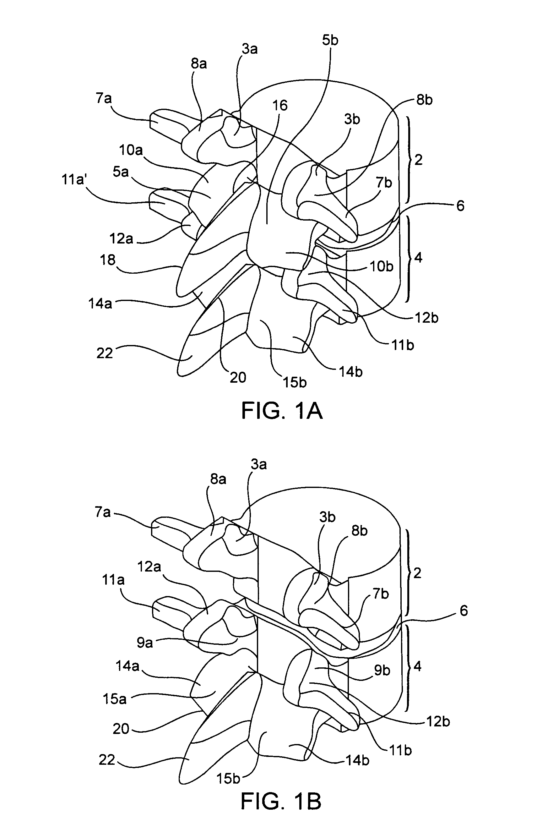 Systems and methods for stabilization of bone structures