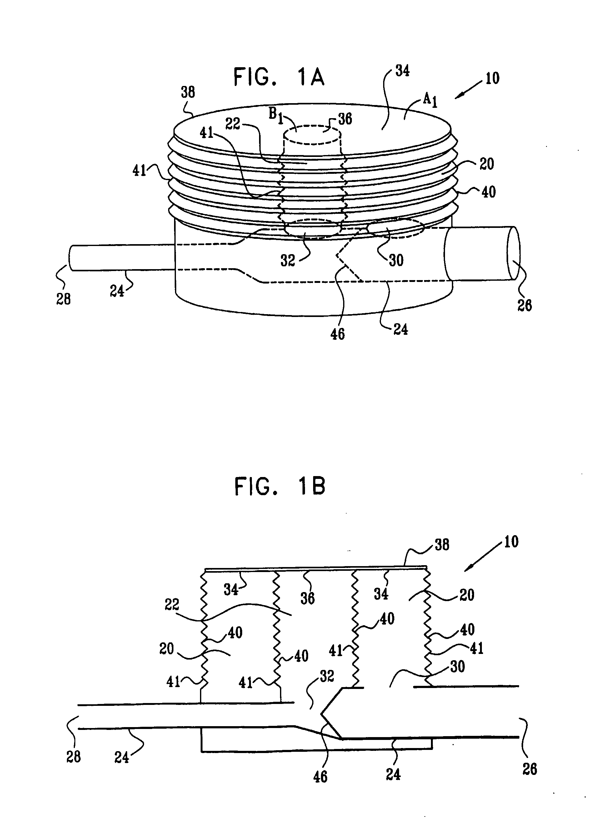 Extracardiac Blood Flow Amplification Device