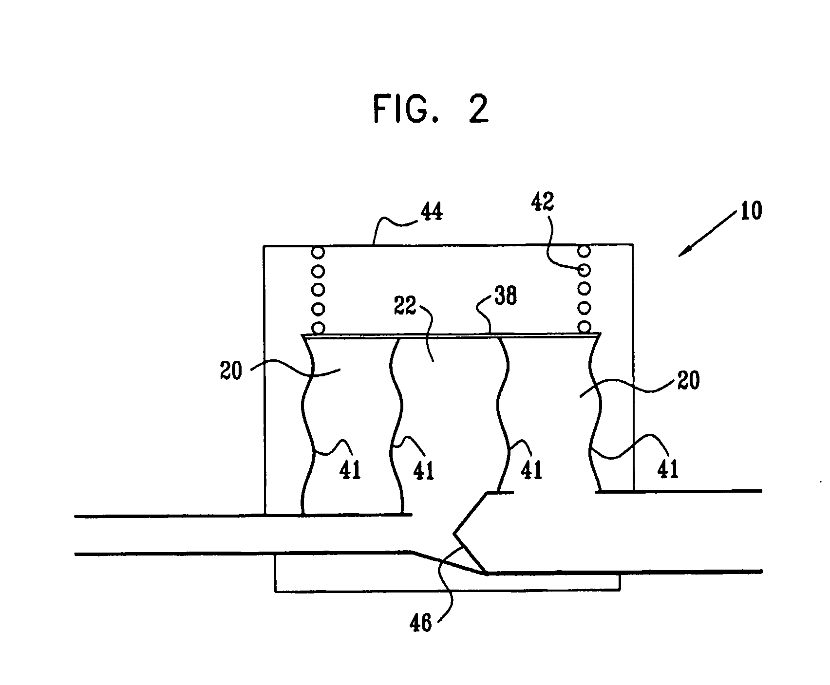Extracardiac Blood Flow Amplification Device