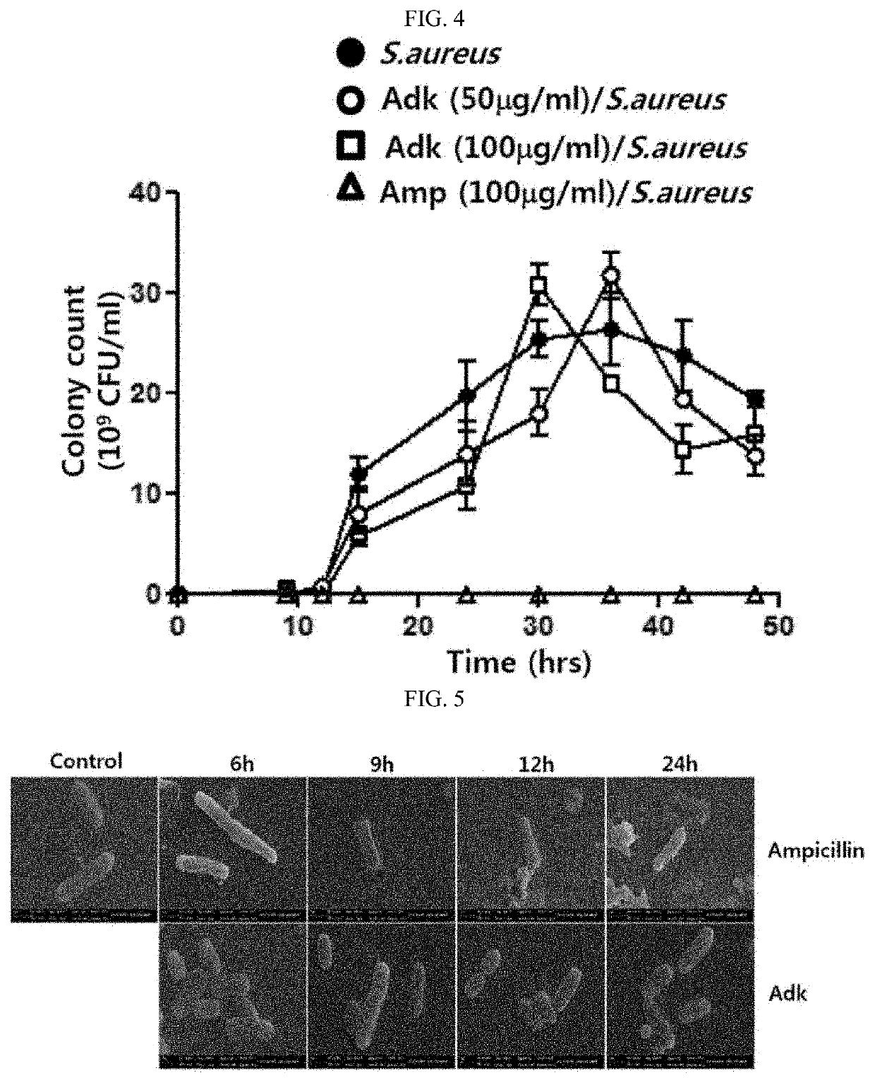 Antibacterial composition containing ADK protein as active ingredient, or composition for preventing or treating sepsis