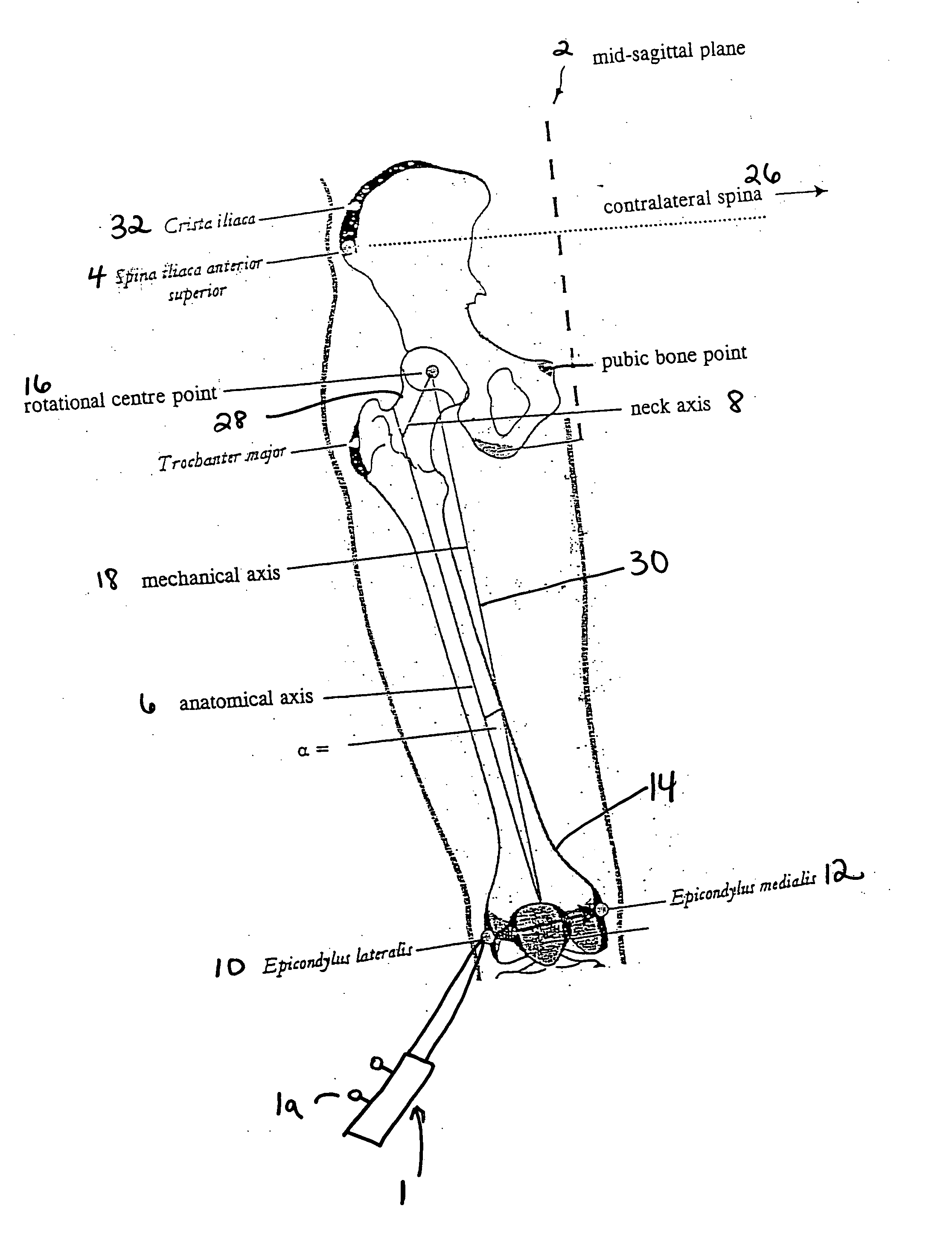 Method and system for generating three-dimensional model of part of a body from fluoroscopy image data and specific landmarks