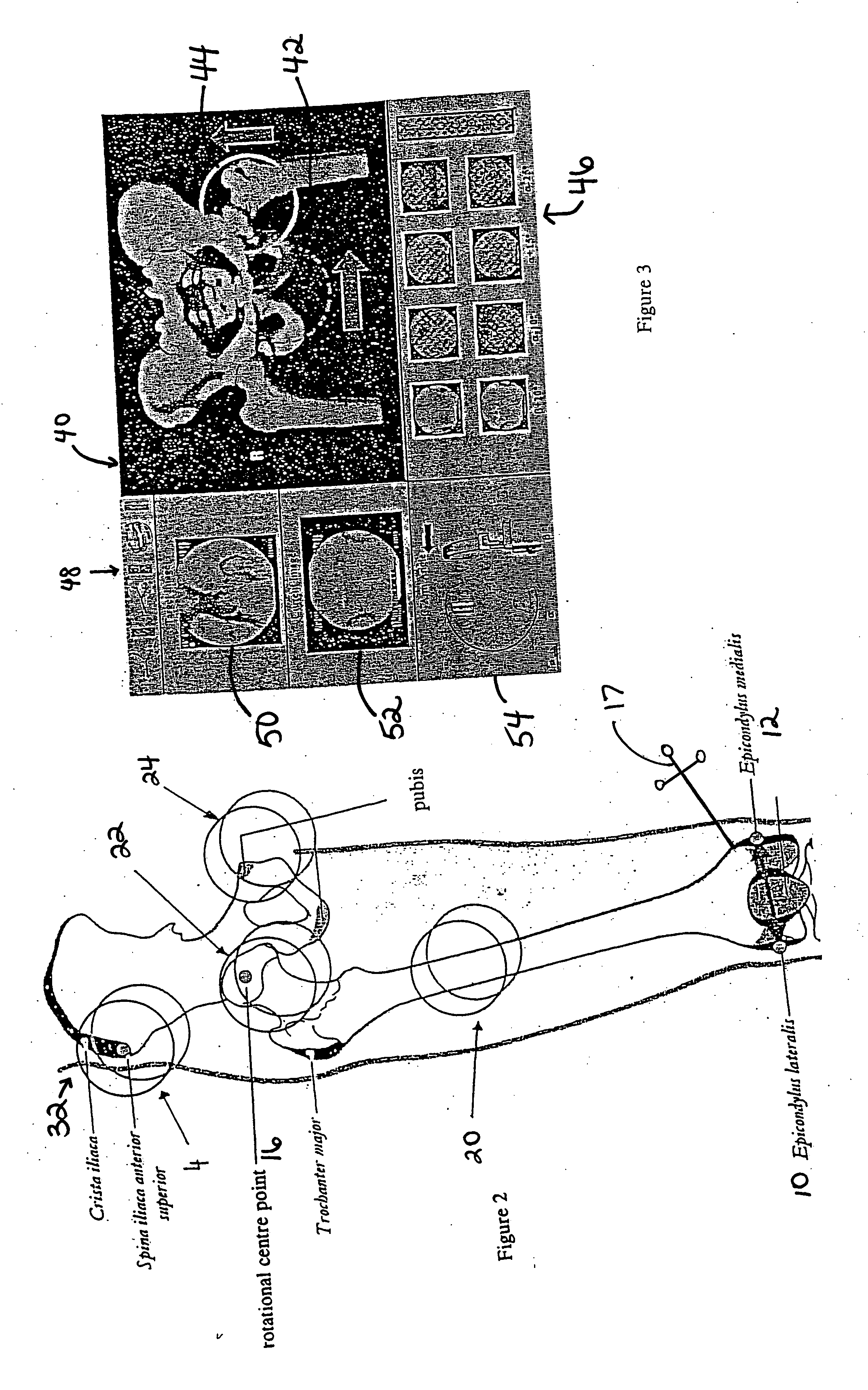 Method and system for generating three-dimensional model of part of a body from fluoroscopy image data and specific landmarks