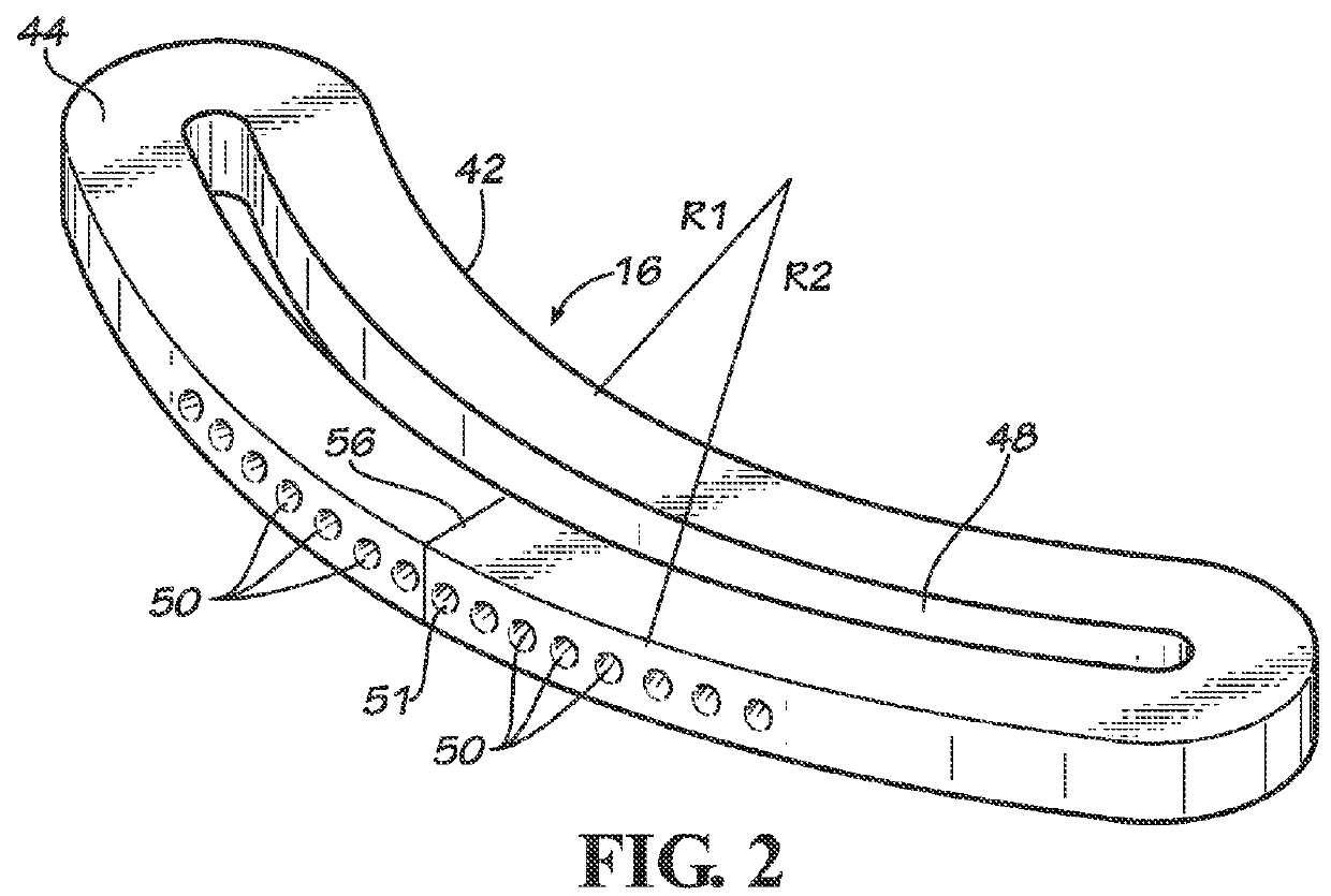 Adjustable orthopaedic joint distractor