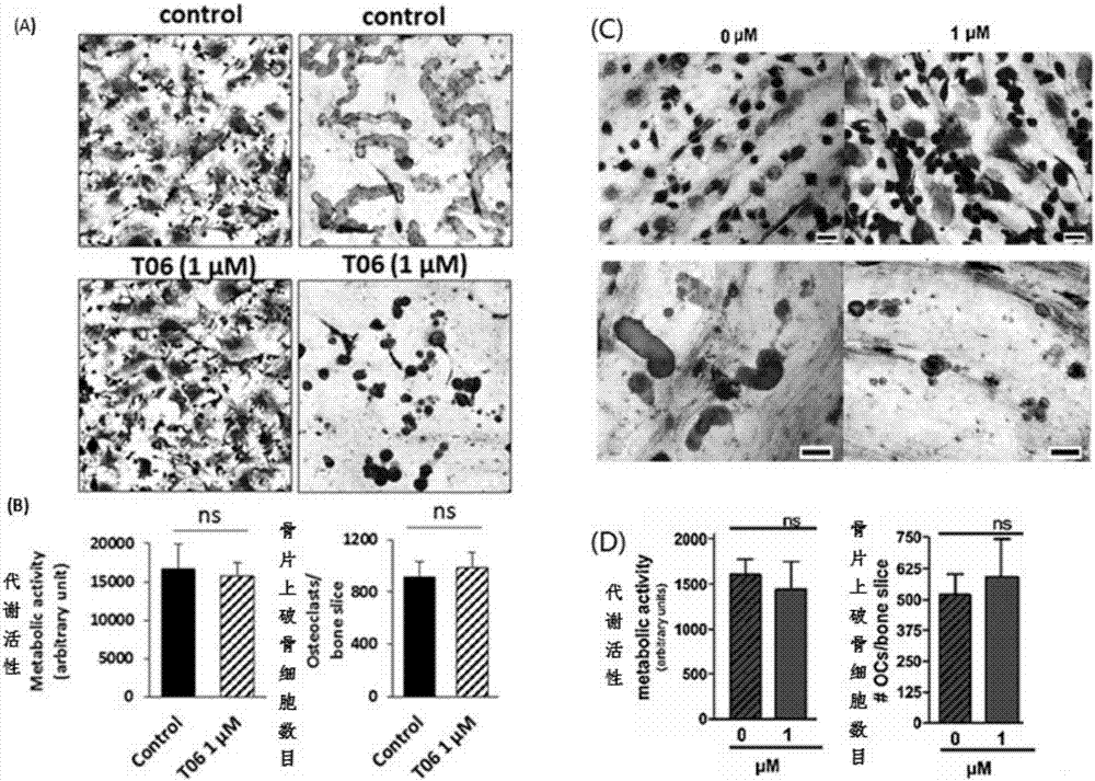 Application of compound to preparation of medicament for cathepsin-K-targeted disease