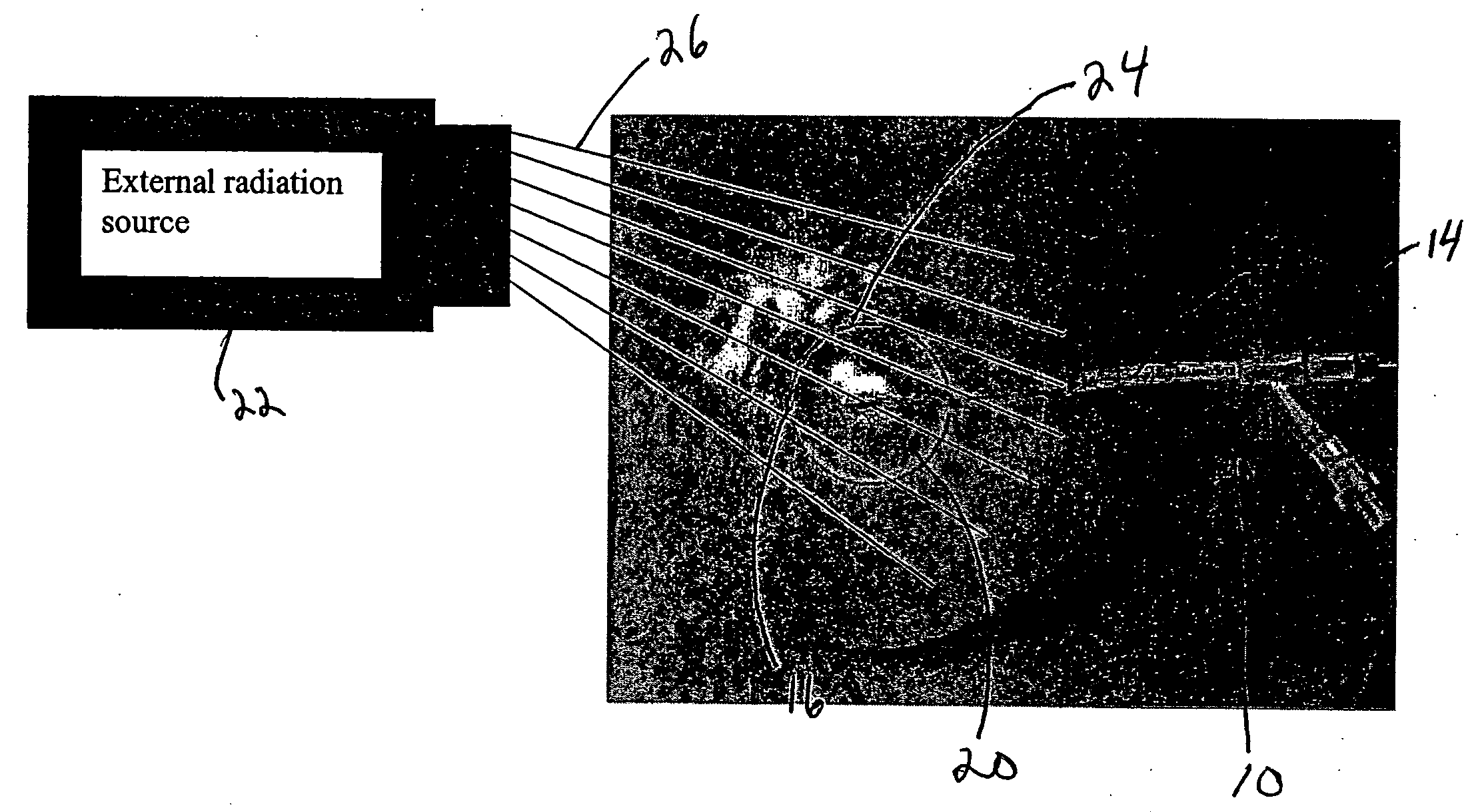 Tissue positioning systems and methods for use with radiation therapy