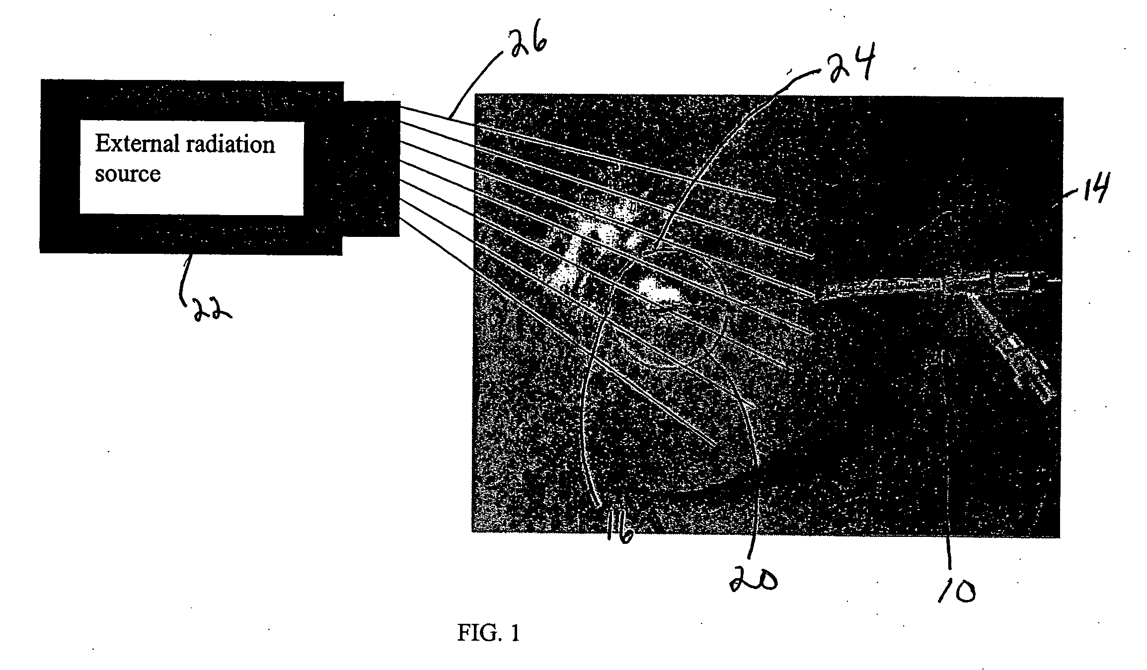 Tissue positioning systems and methods for use with radiation therapy