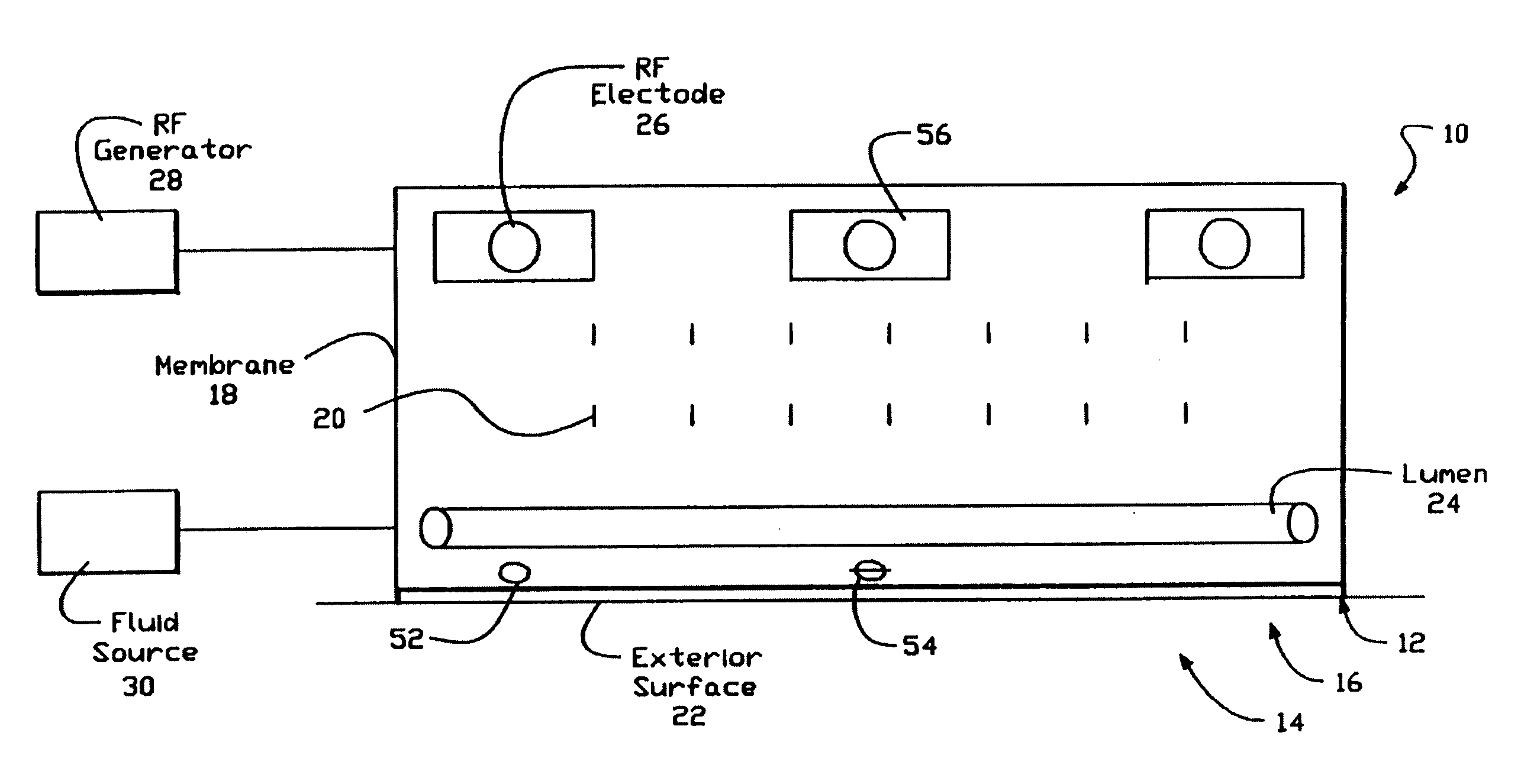 Apparatus for the treatment of hyperhidrosis