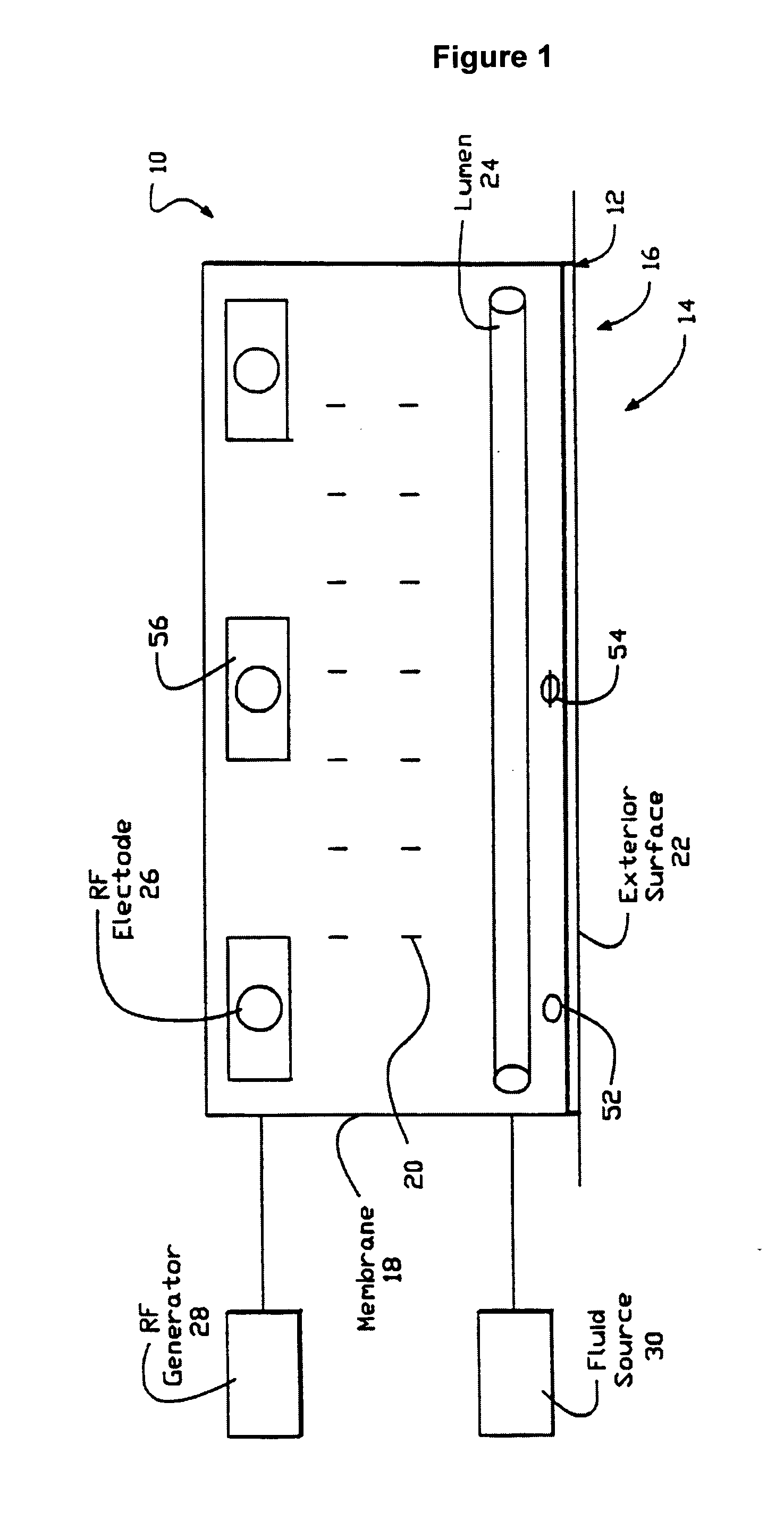 Apparatus for the treatment of hyperhidrosis