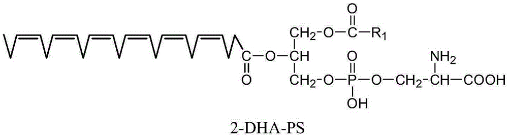 Method for preparing phospholipids type DHA through catalysis of biological enzyme