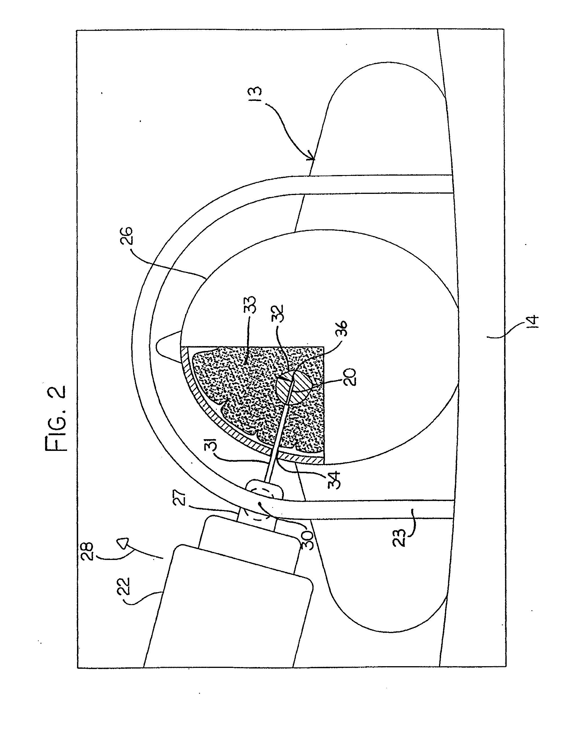 Hyperthermia treatment and probe therefor