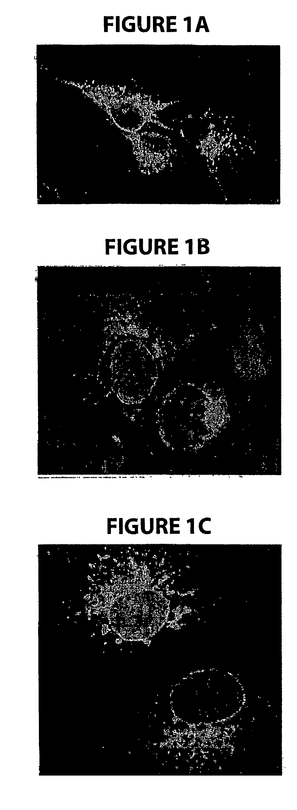 Npc1l1 and npc1l1 inhibitors and methods of use thereof