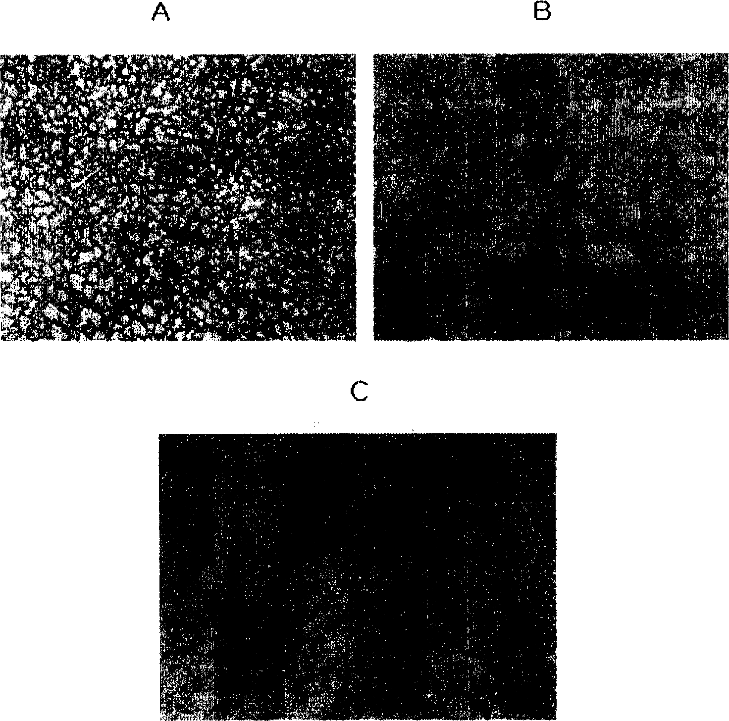 Composition for preventing or treating allergic disease using black rice extract and its therapeutic use