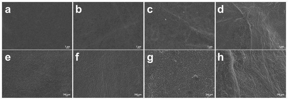 A kind of amyloid nanocellulose composite film and its preparation method and application