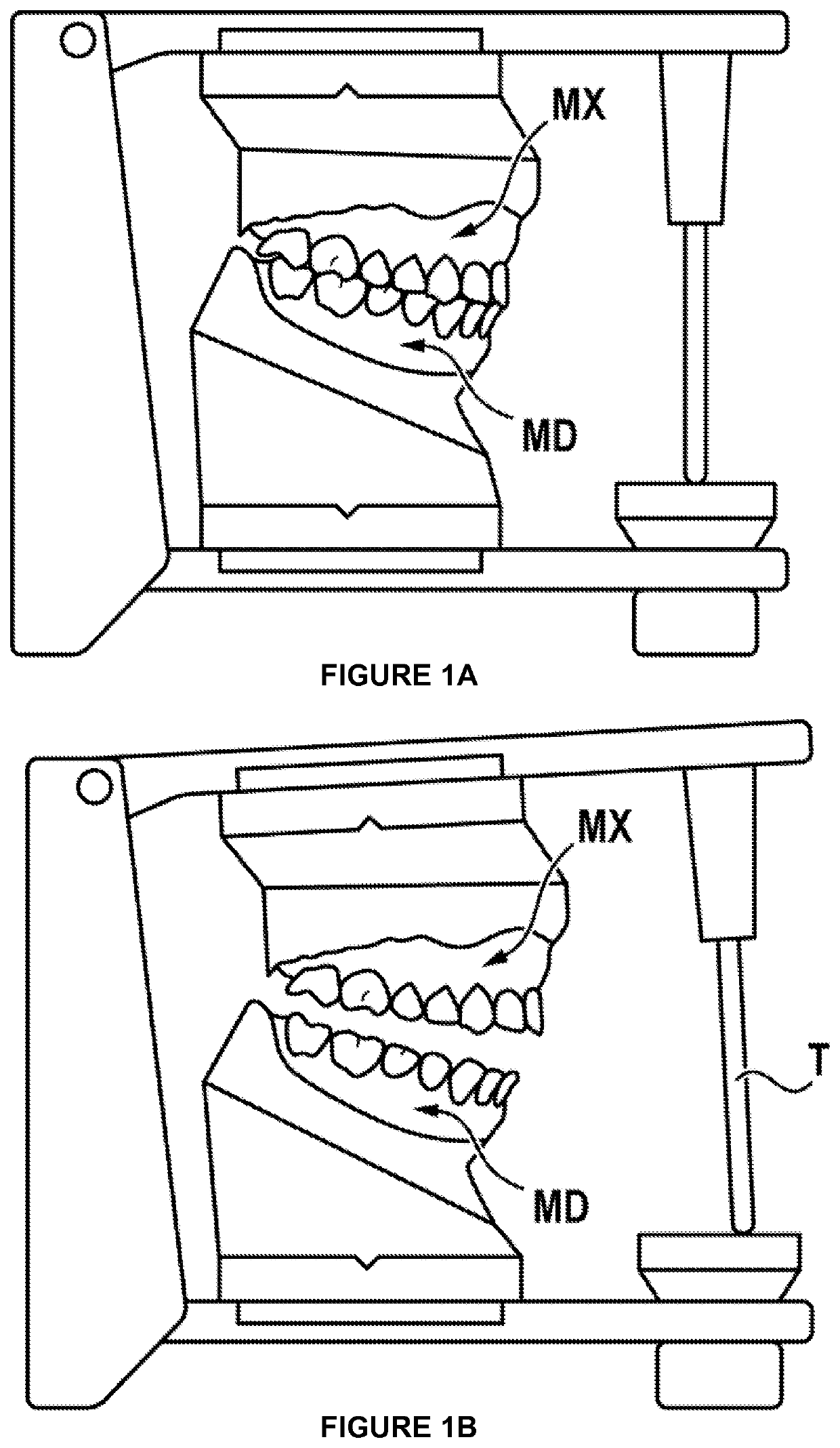 Method for animating models of the mandibular and maxillary arches of a patient in a corrected intermaxillary relationship