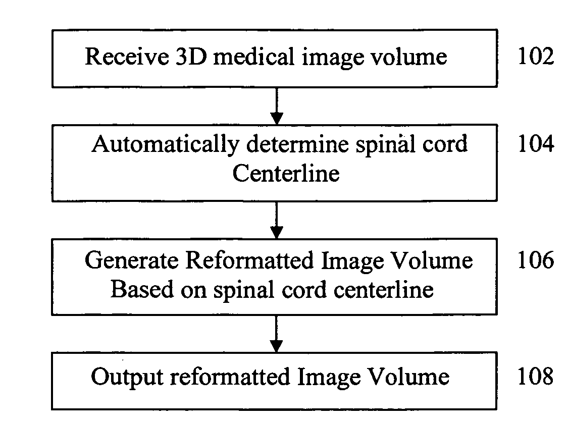 Method and system for spine visualization in 3D medical images