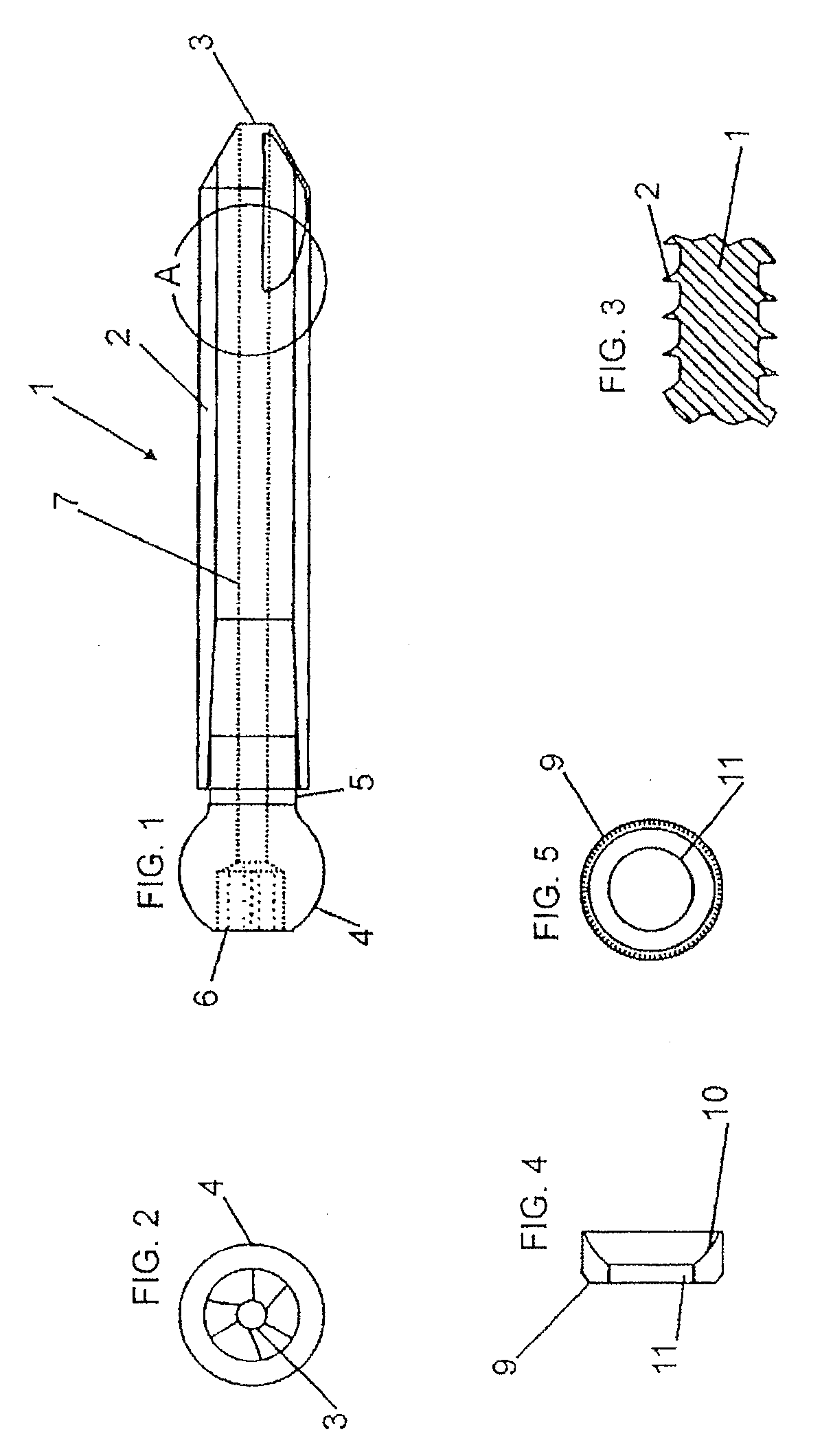 Pedicular percutaneous minimally invasive screw