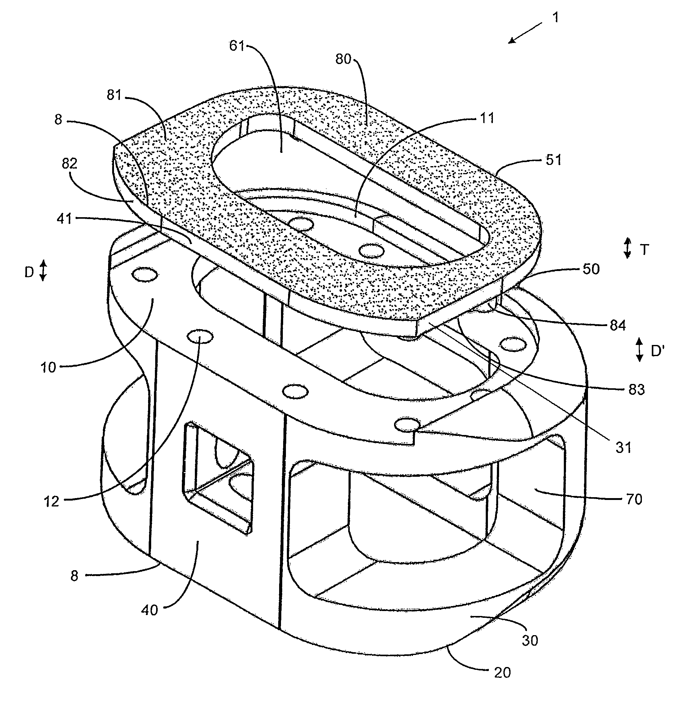 Spinal implant and integration plate for optimizing vertebral endplate contact load-bearing edges