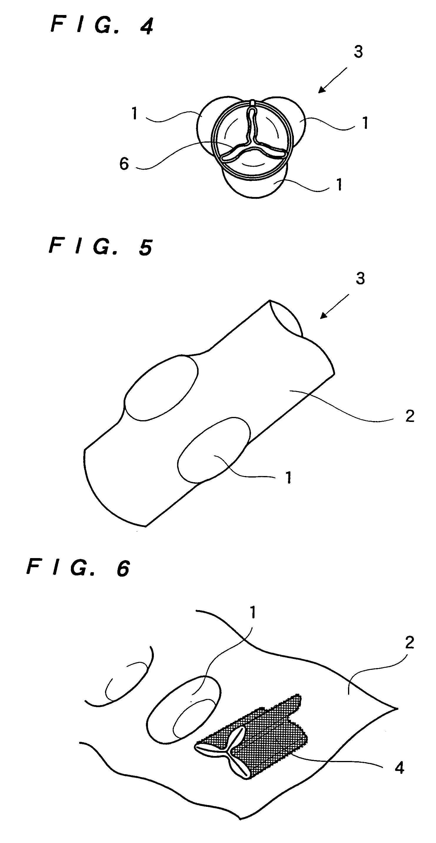 Mechanical heart valve and production method thereof