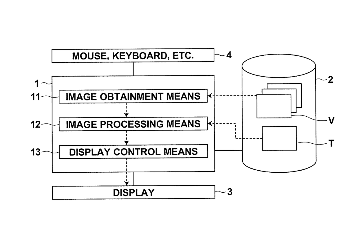 Image processing apparatus, method and program