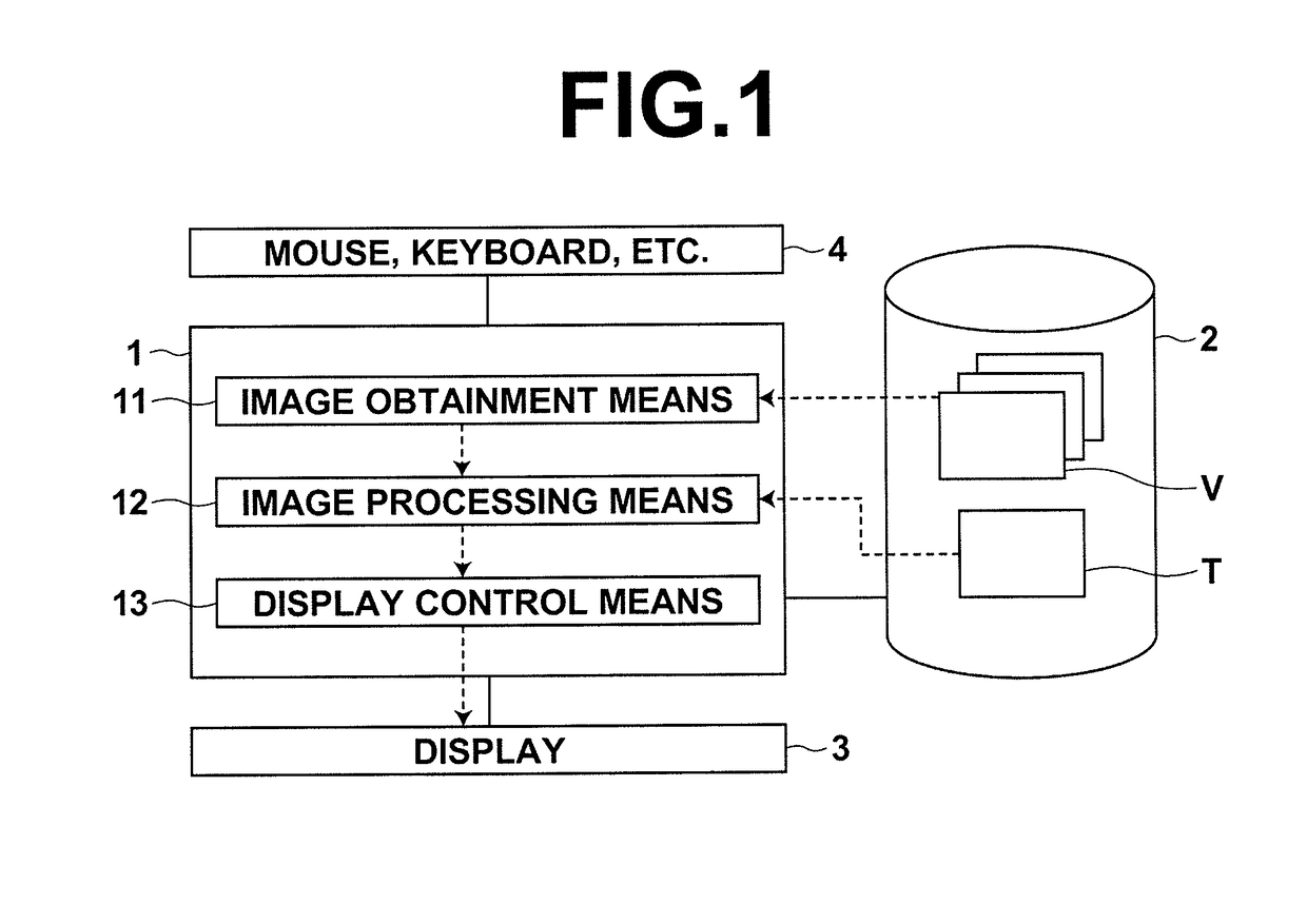 Image processing apparatus, method and program