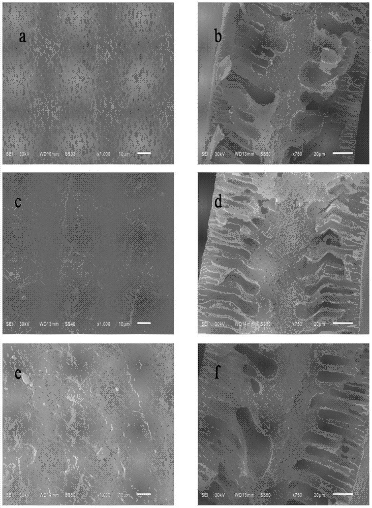 Preparation method for chiral separation benzenesulfonic acid amlodipine molecularly imprinted membrane