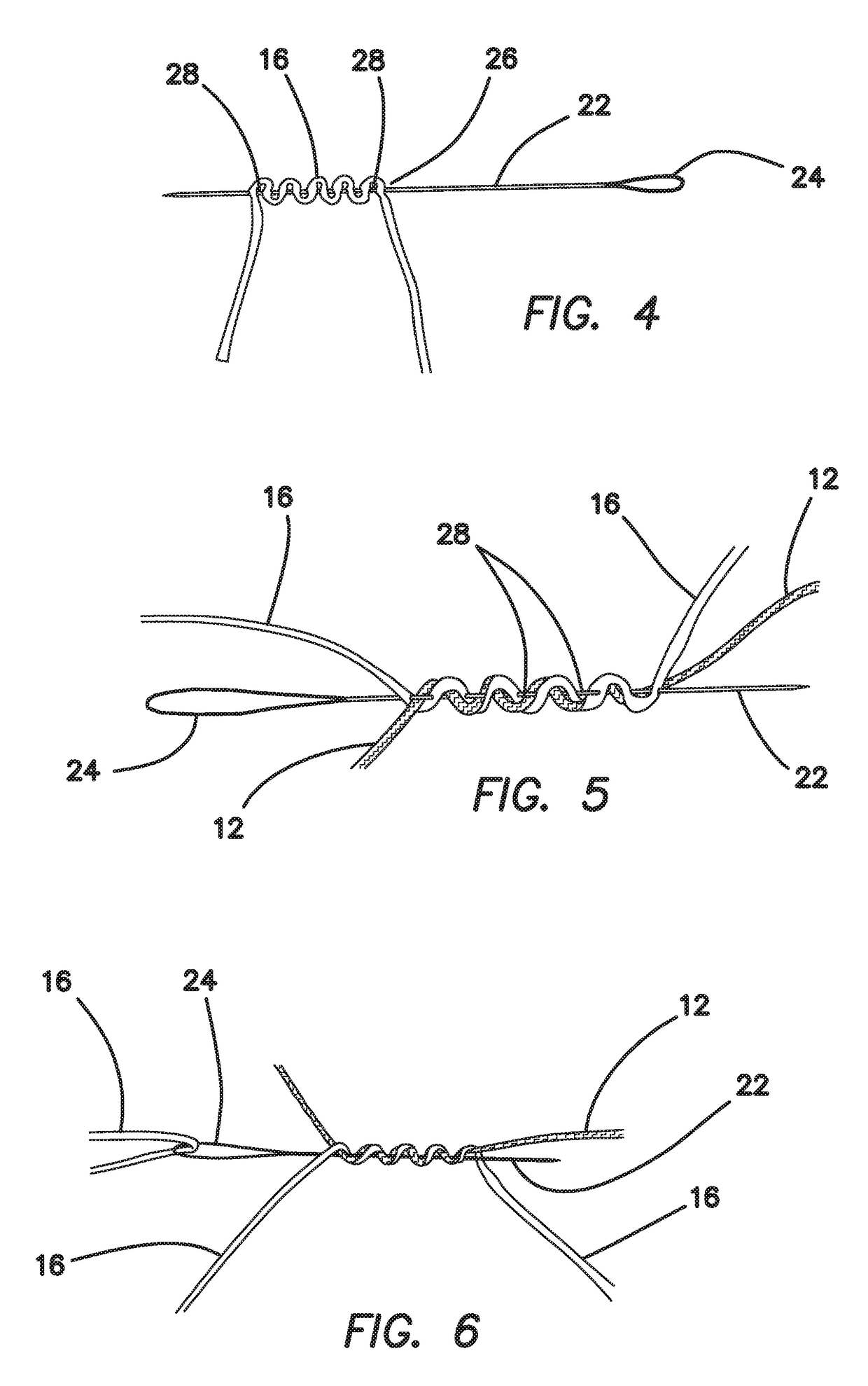 All-suture suture anchor systems and methods