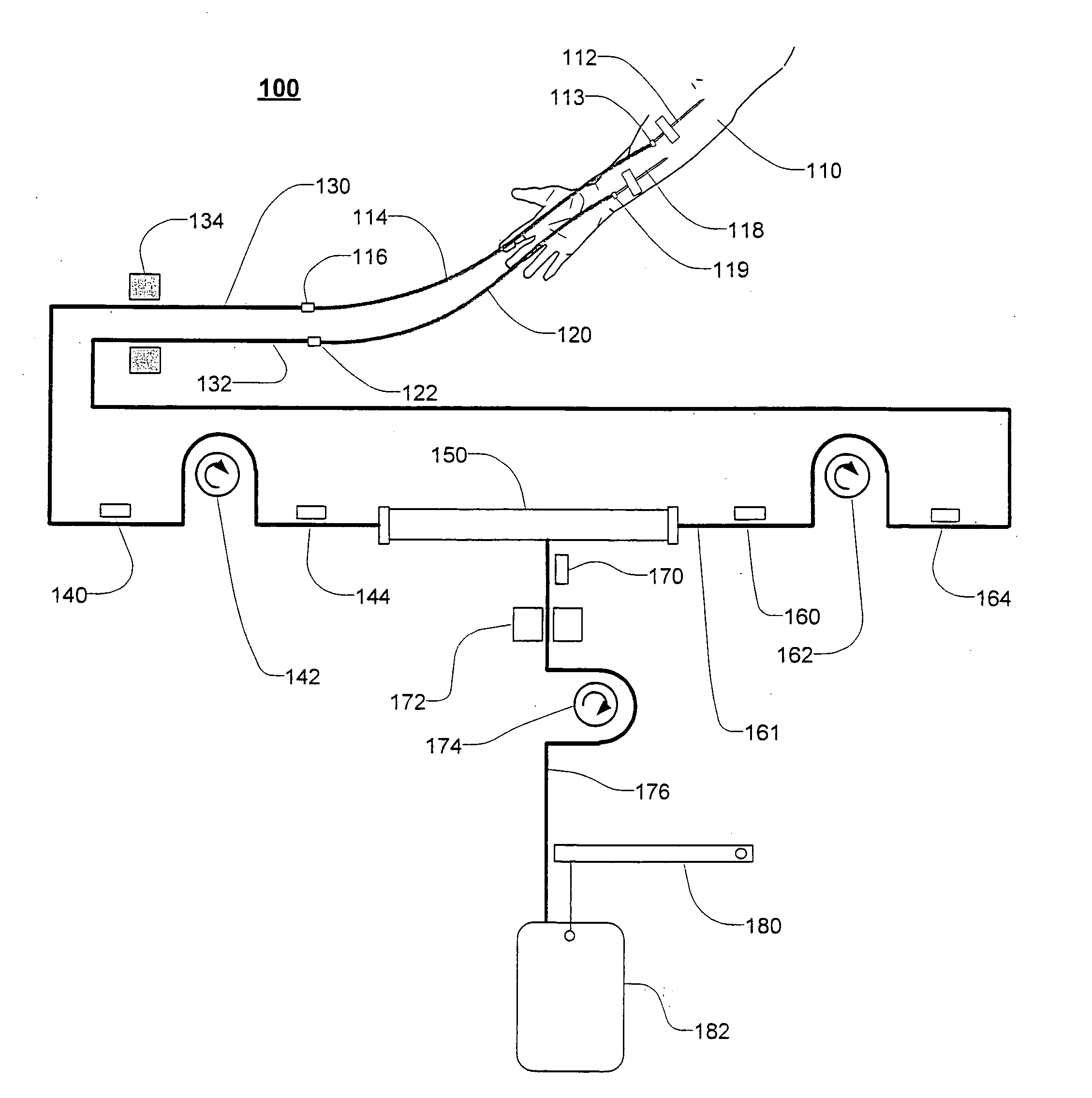 Extracorporeal blood treatment and system having reversible blood pumps