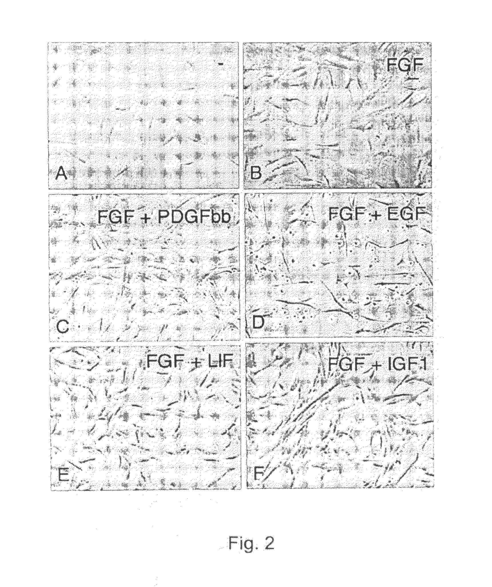 Skeletal muscle periangioblasts and cardiac mesangioblasts, method for isolation and uses thereof
