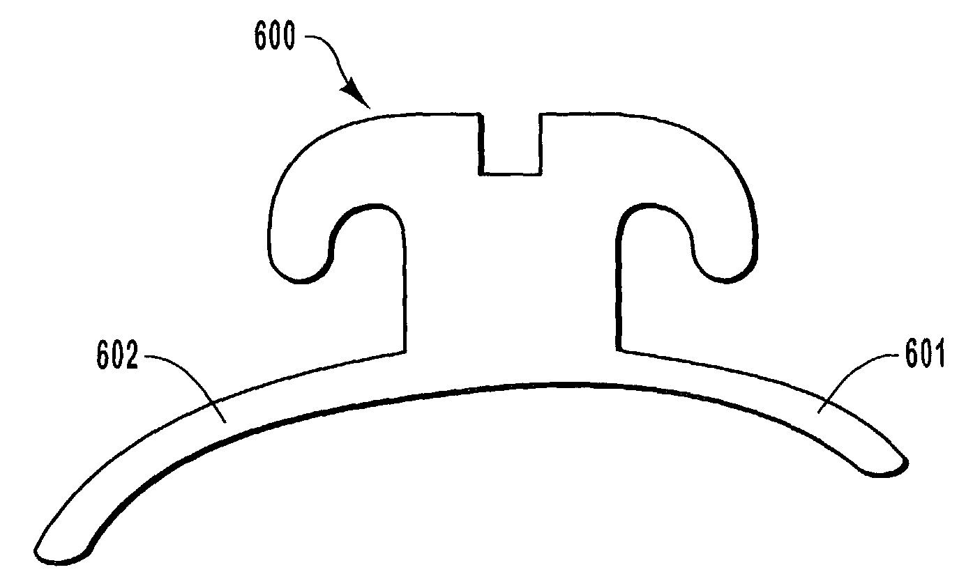 Custom-fitted orthodontic bracket manufactured by computerized and selective removal of portions of a bracket