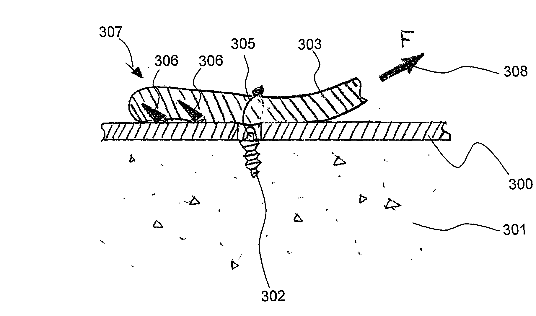 Apparatus for discrete tissue anchoring for soft tissue repair and method of use