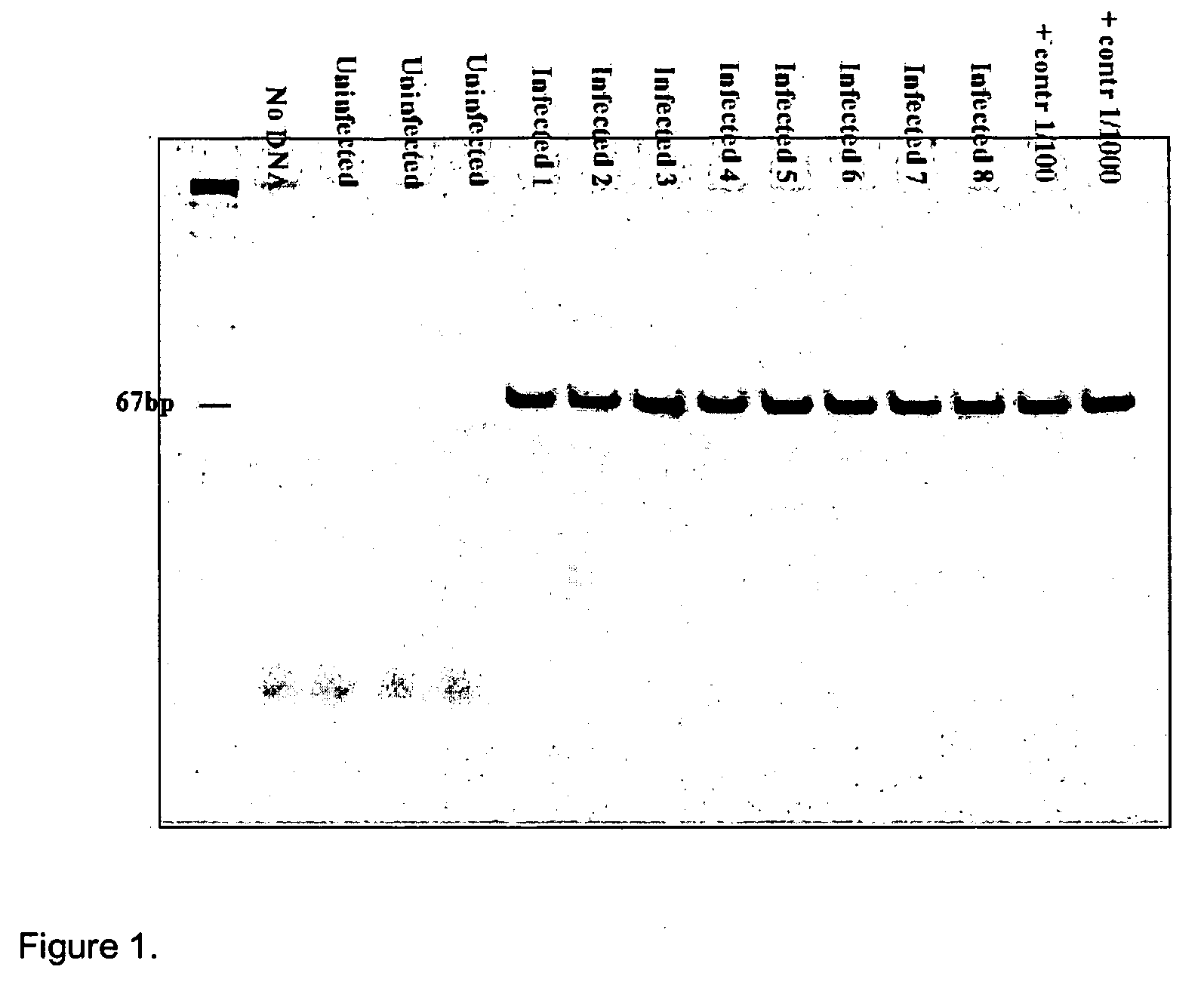 Method for diagnosis and monitoring of pathogenic infection by analysis of pathogenic transrenal nucleic acids in urine