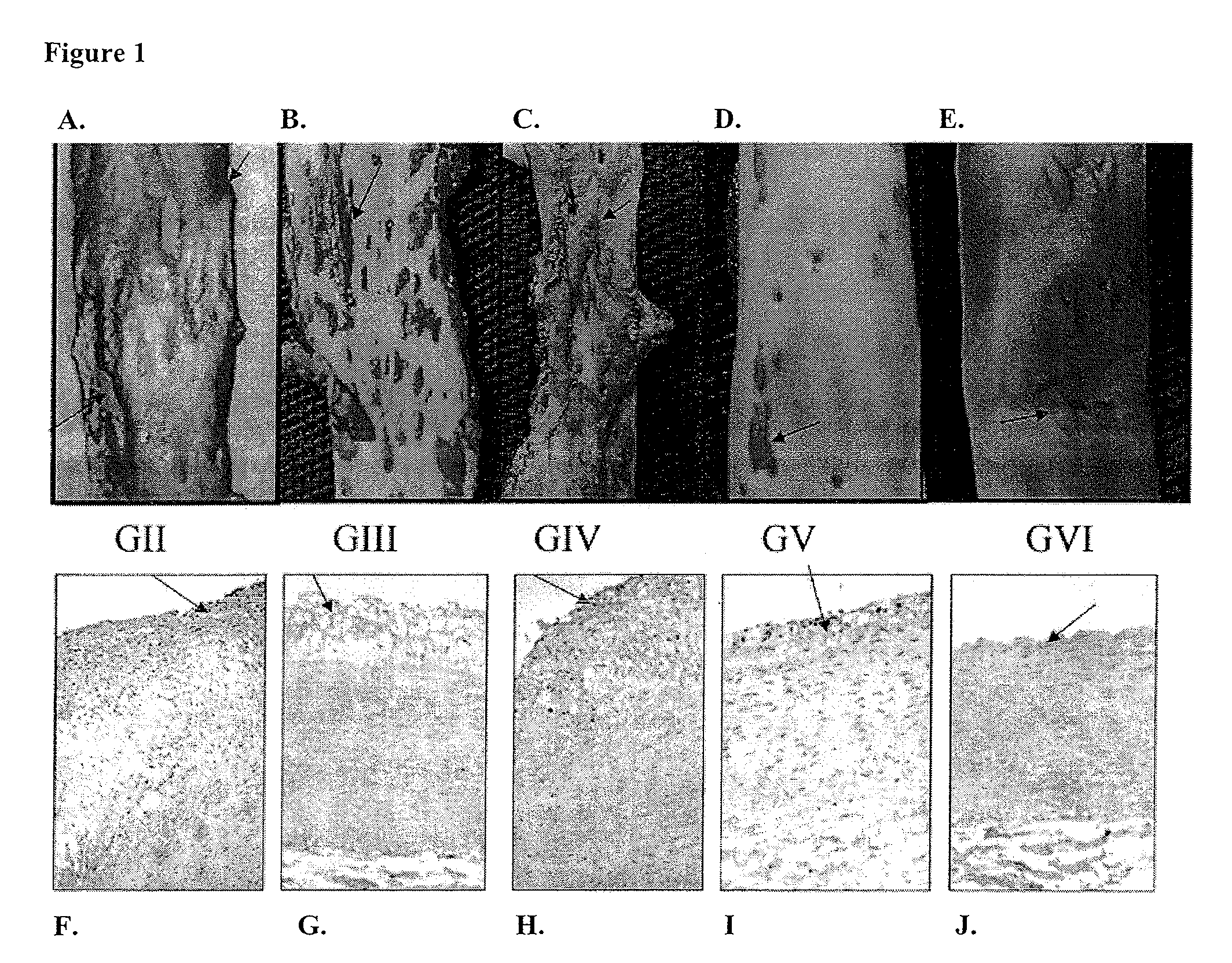 Compositions for inhibiting atherosclerosis