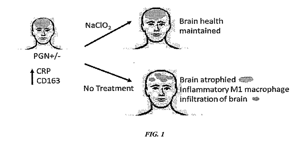 Treatment of neurodegenerative disease with sodium chlorite