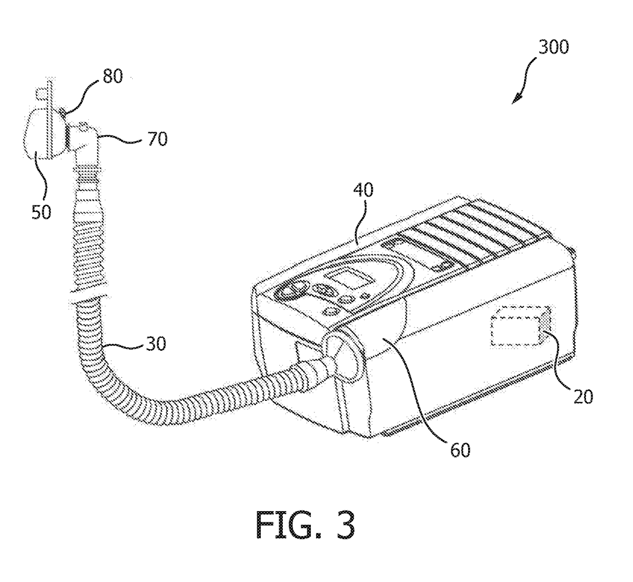 Method and systems for patient airway and leak flow estimation for non-invasive ventilation