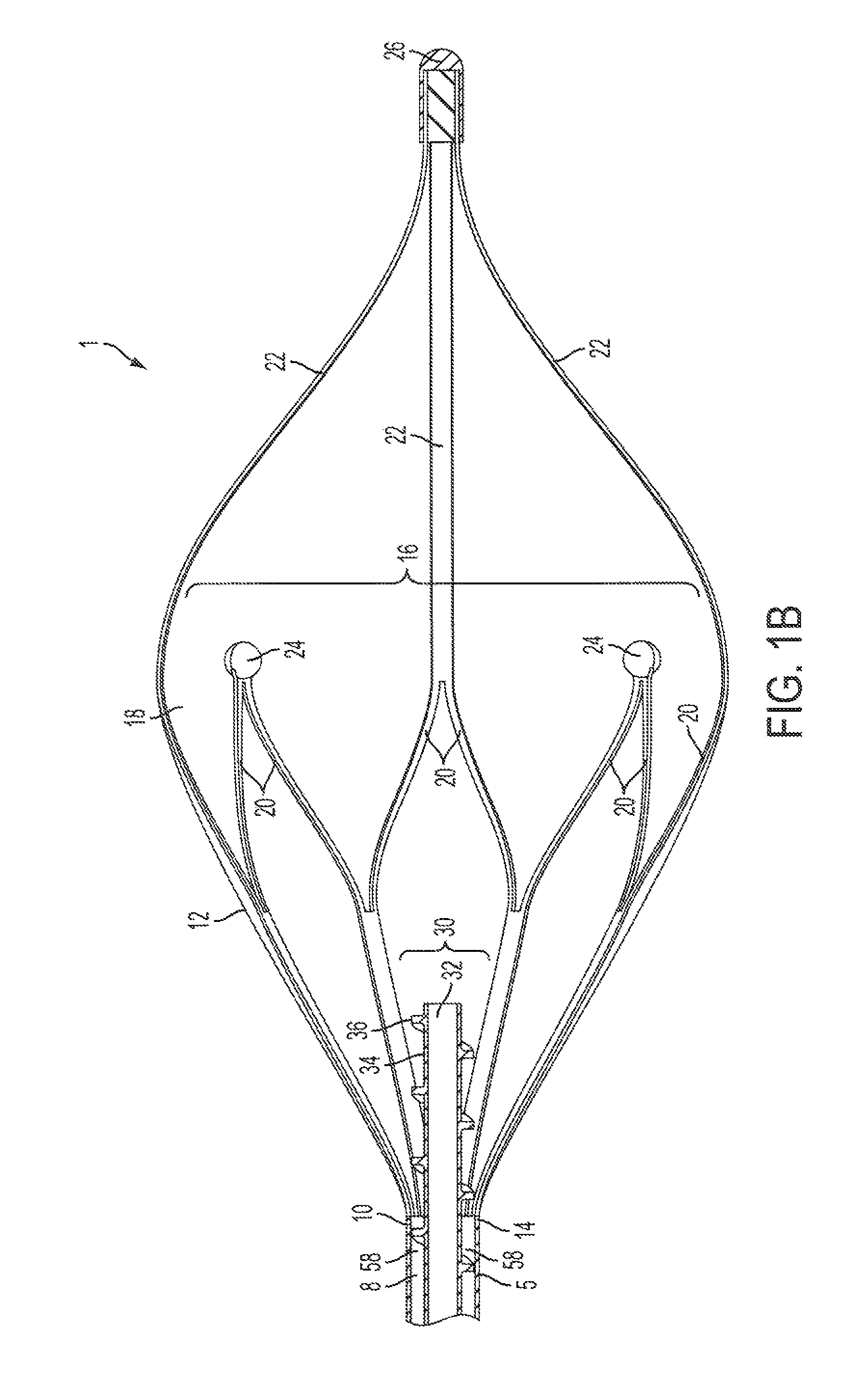 Device and method for removing material from a hollow anatomical structure
