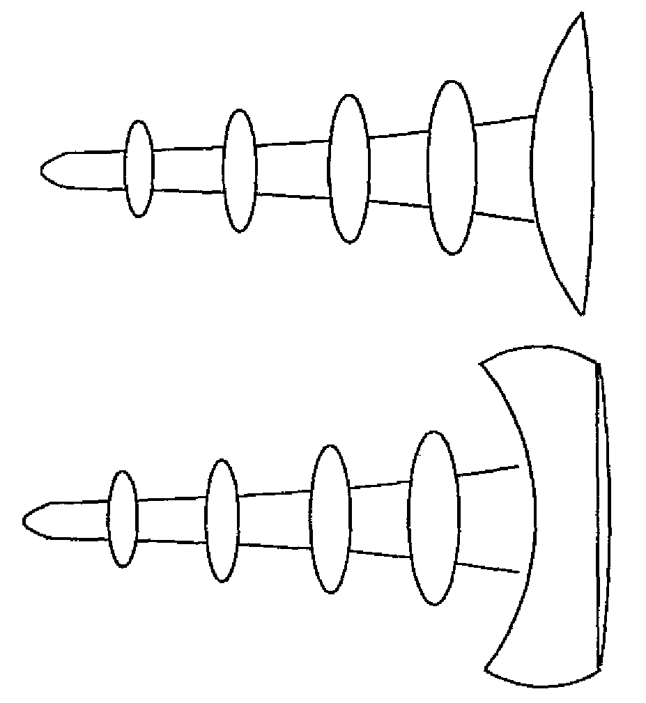 Anti-backout arthroscopic uni-compartmental prosthesis